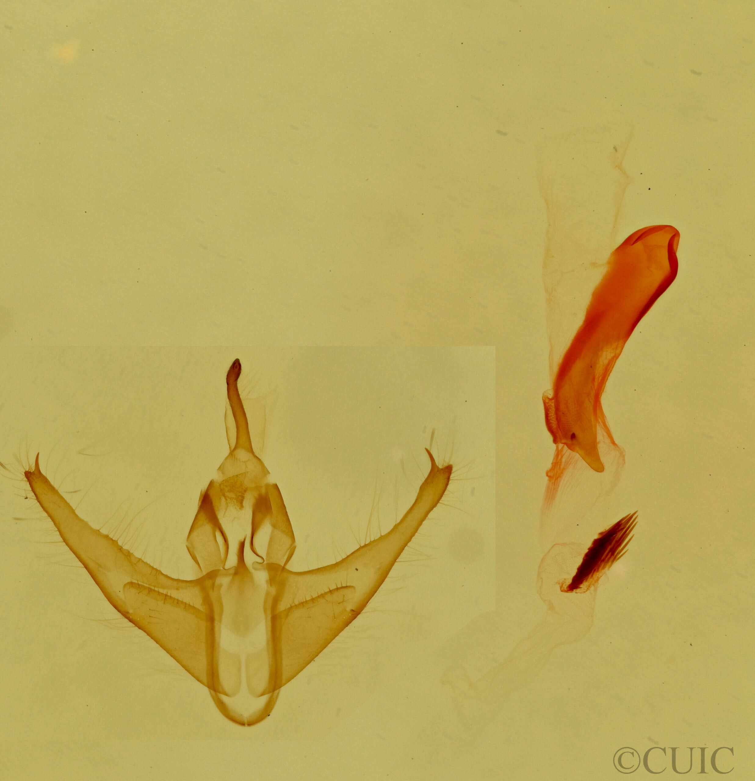 genitalia view of adult Amiana niama