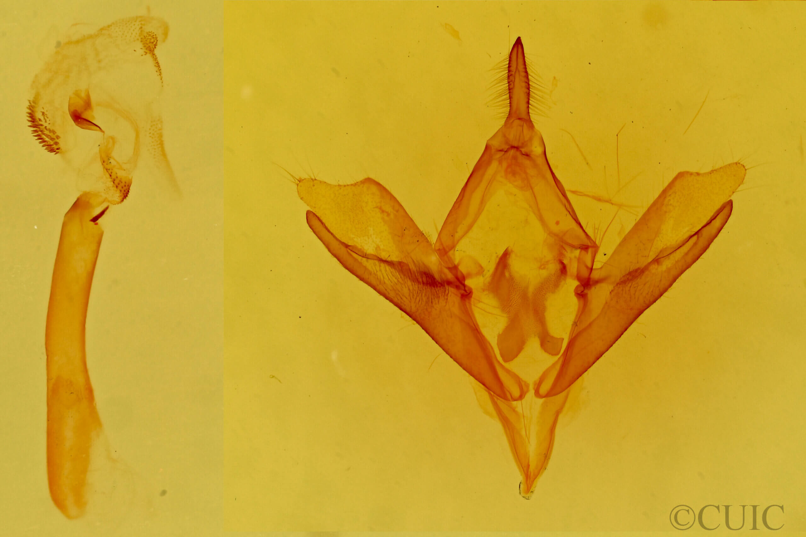 genitalia view of adult Callistege intercalaris