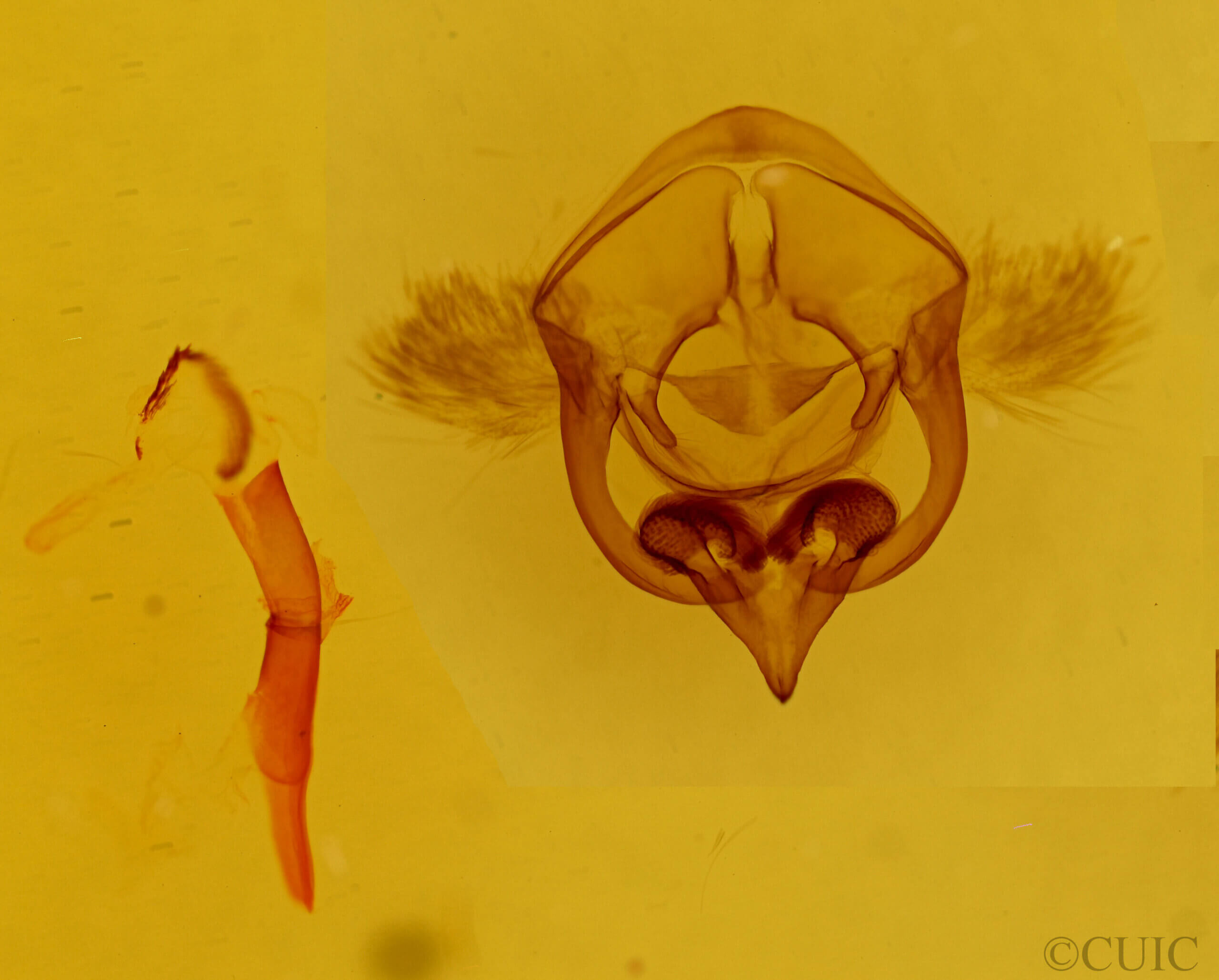 genitalia view of adult Euchaetes fusca