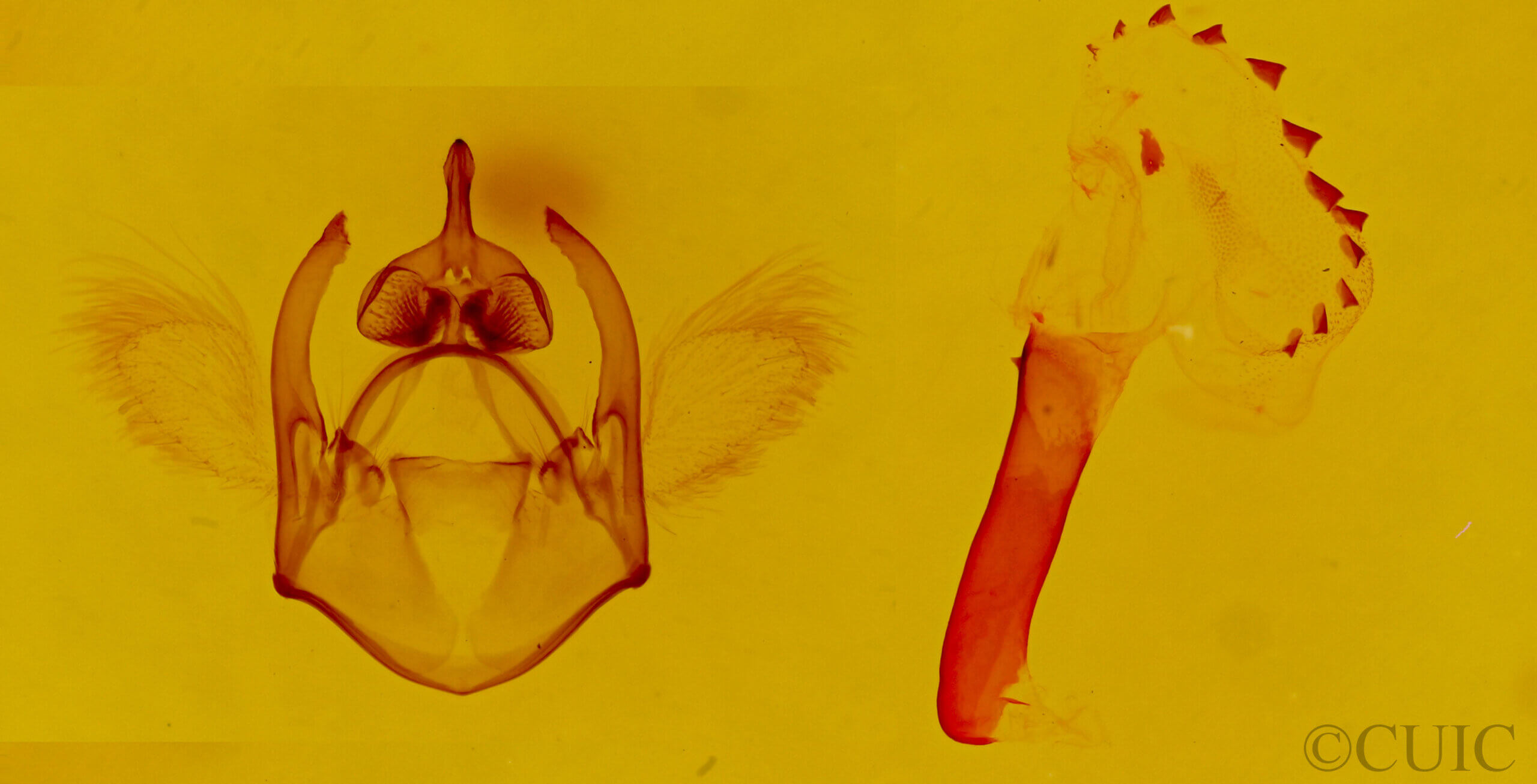 genitalia view of adult Euchaetes zella