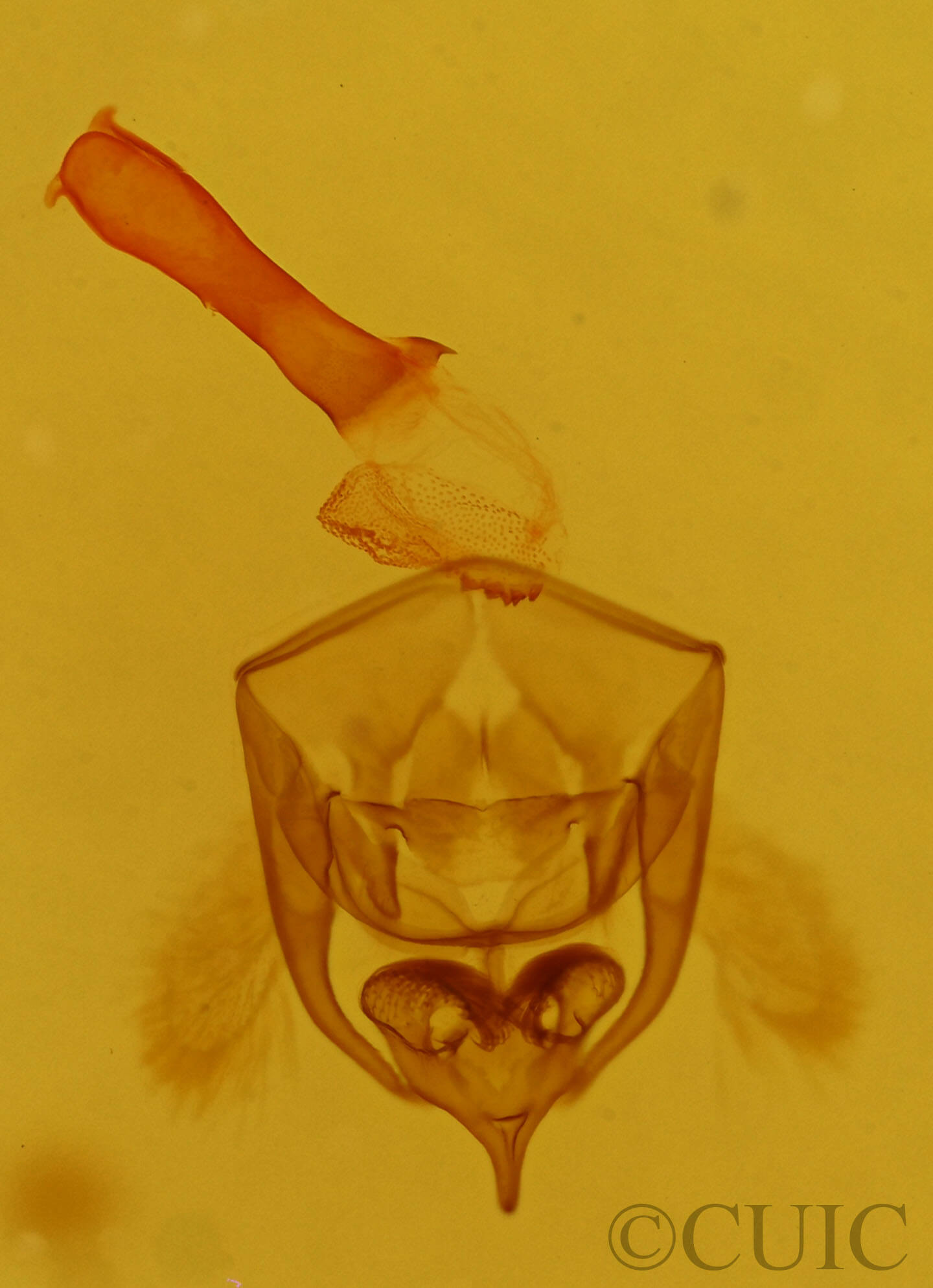 genitalia view of adult Euchaetes perlevis