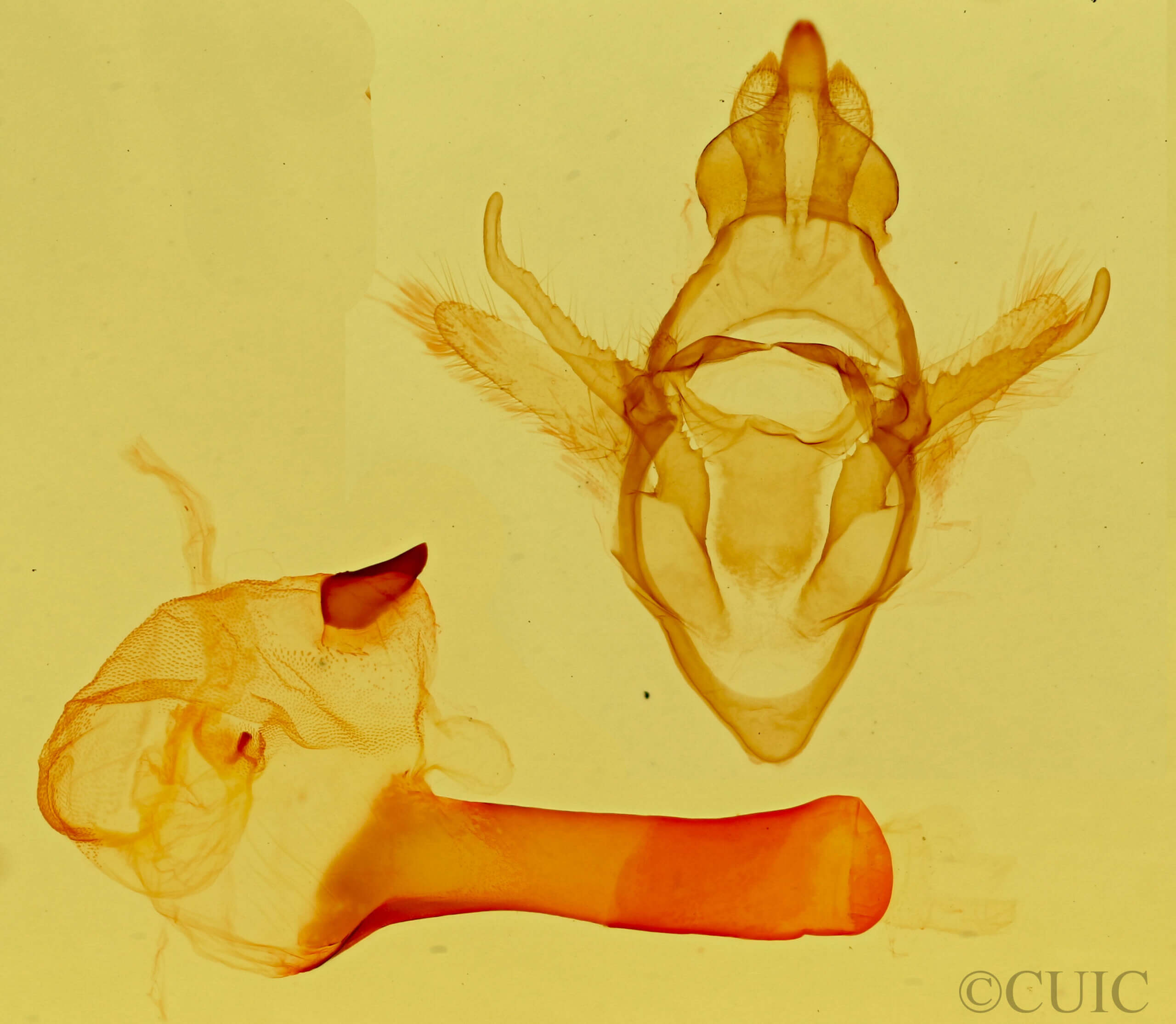 genitalia view of adult Paraeuchaetes insulata