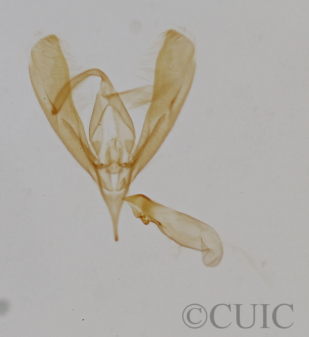 genitalia view of adult Cobubatha dividua