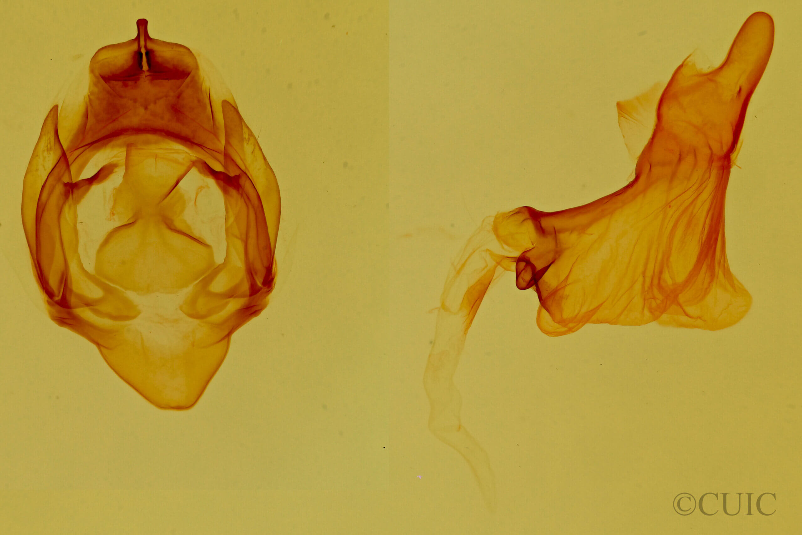 genitalia view of adult Hypercompe permaculata