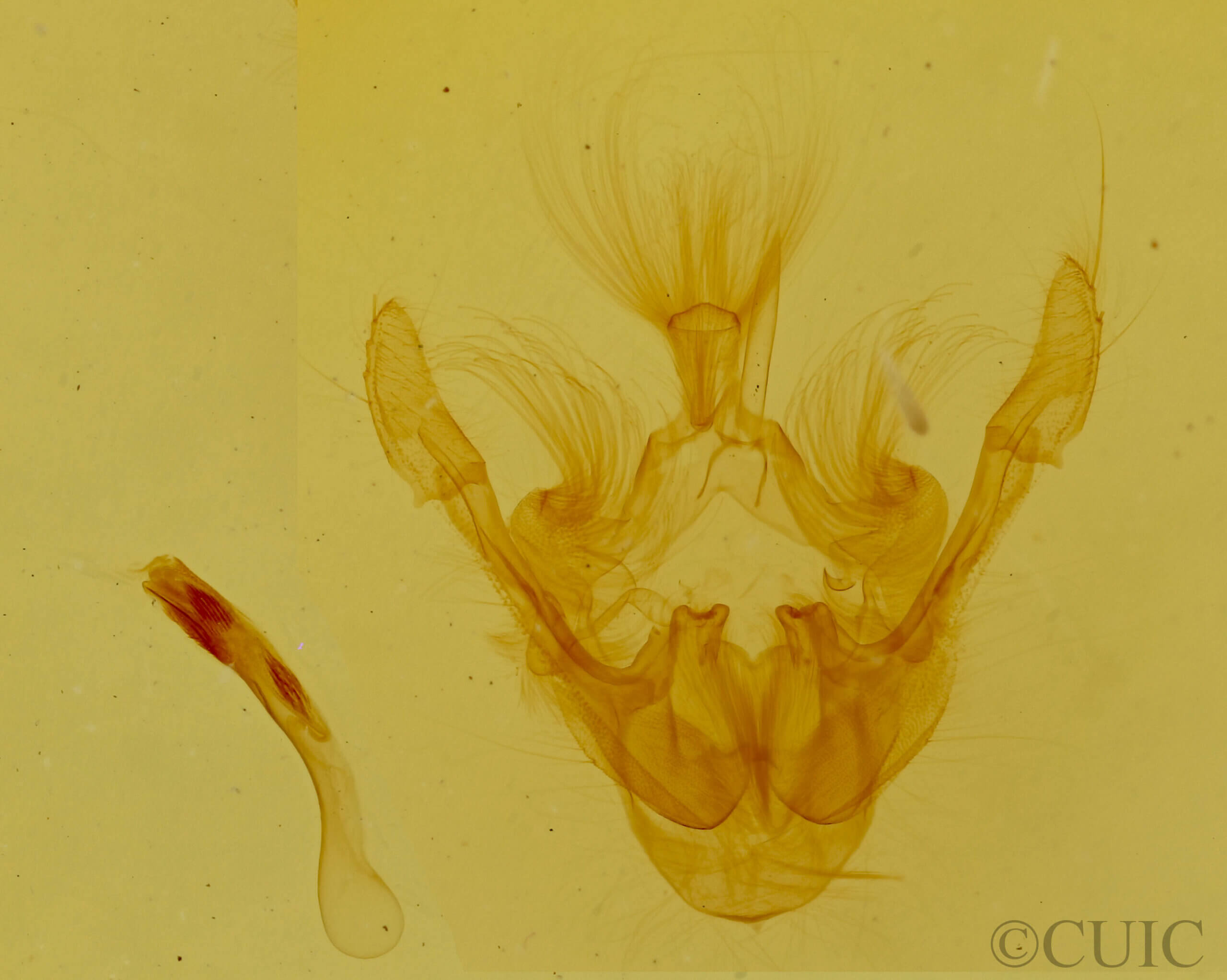 genitalia view of adult Mesoligia furuncula