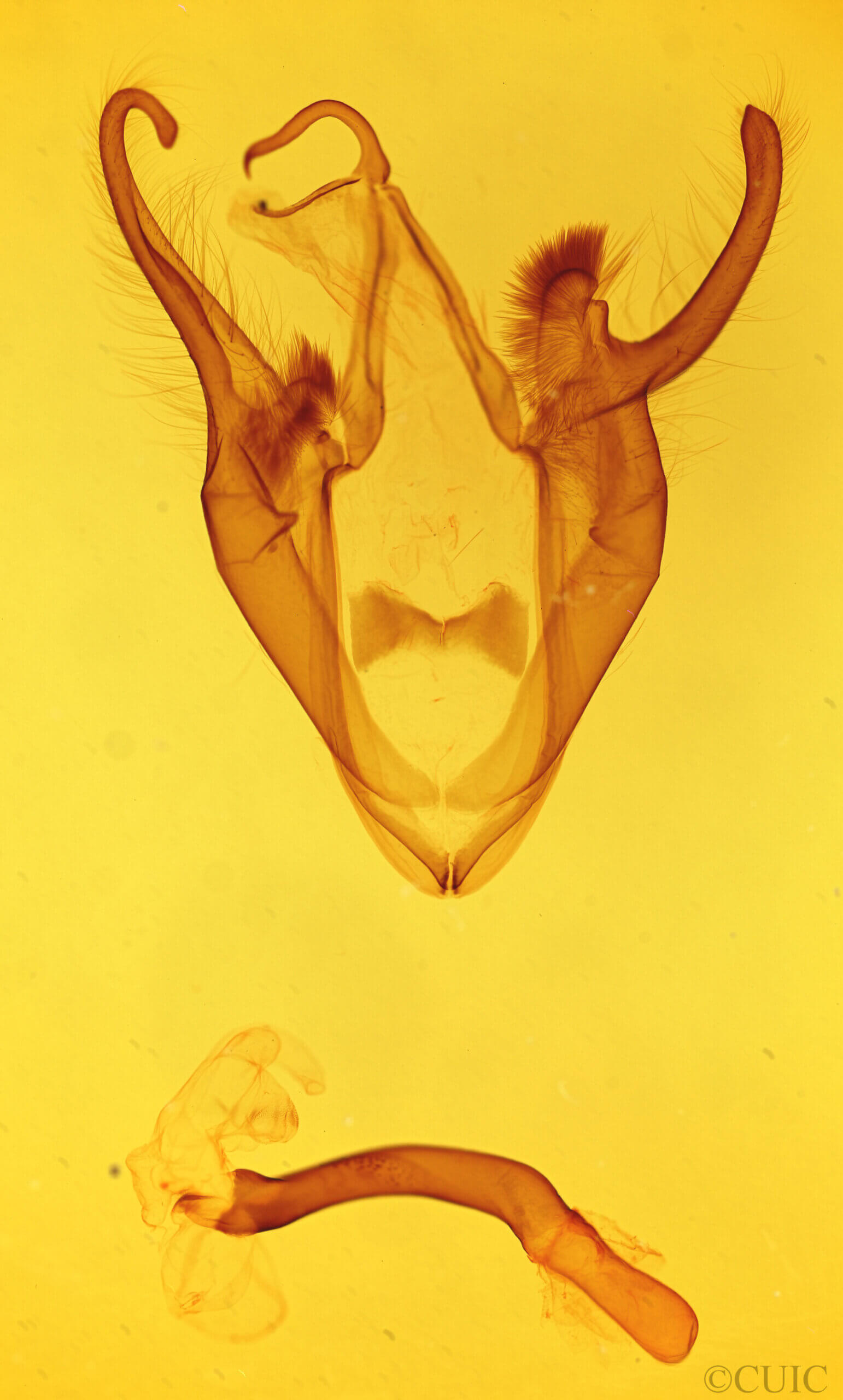 genitalia view of adult Zale buchholzi