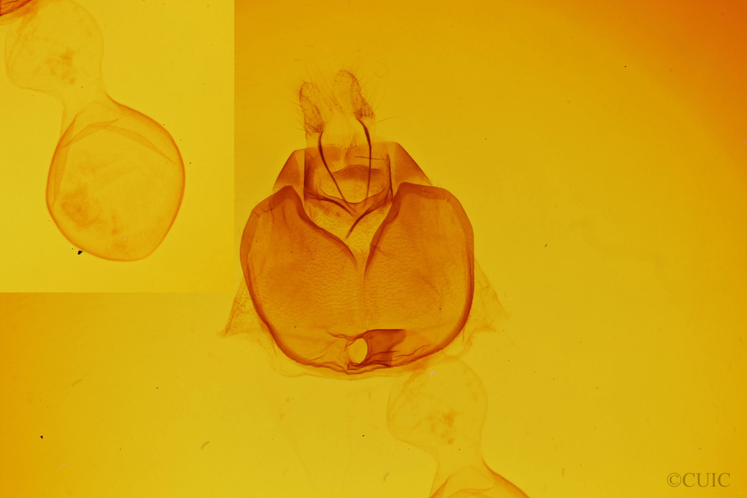 genitalia view of adult Zale galbanata