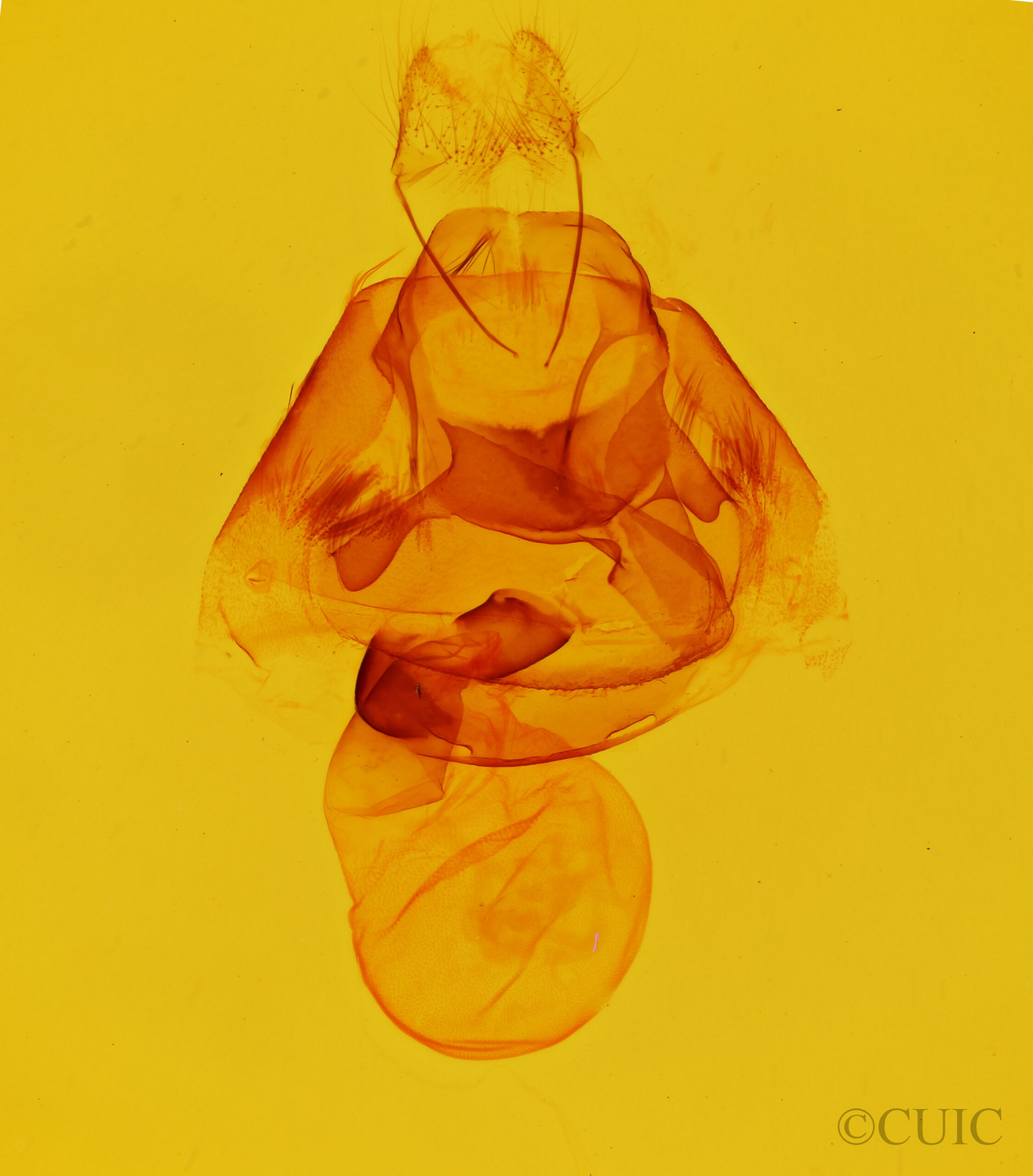 genitalia view of adult Zale edusina