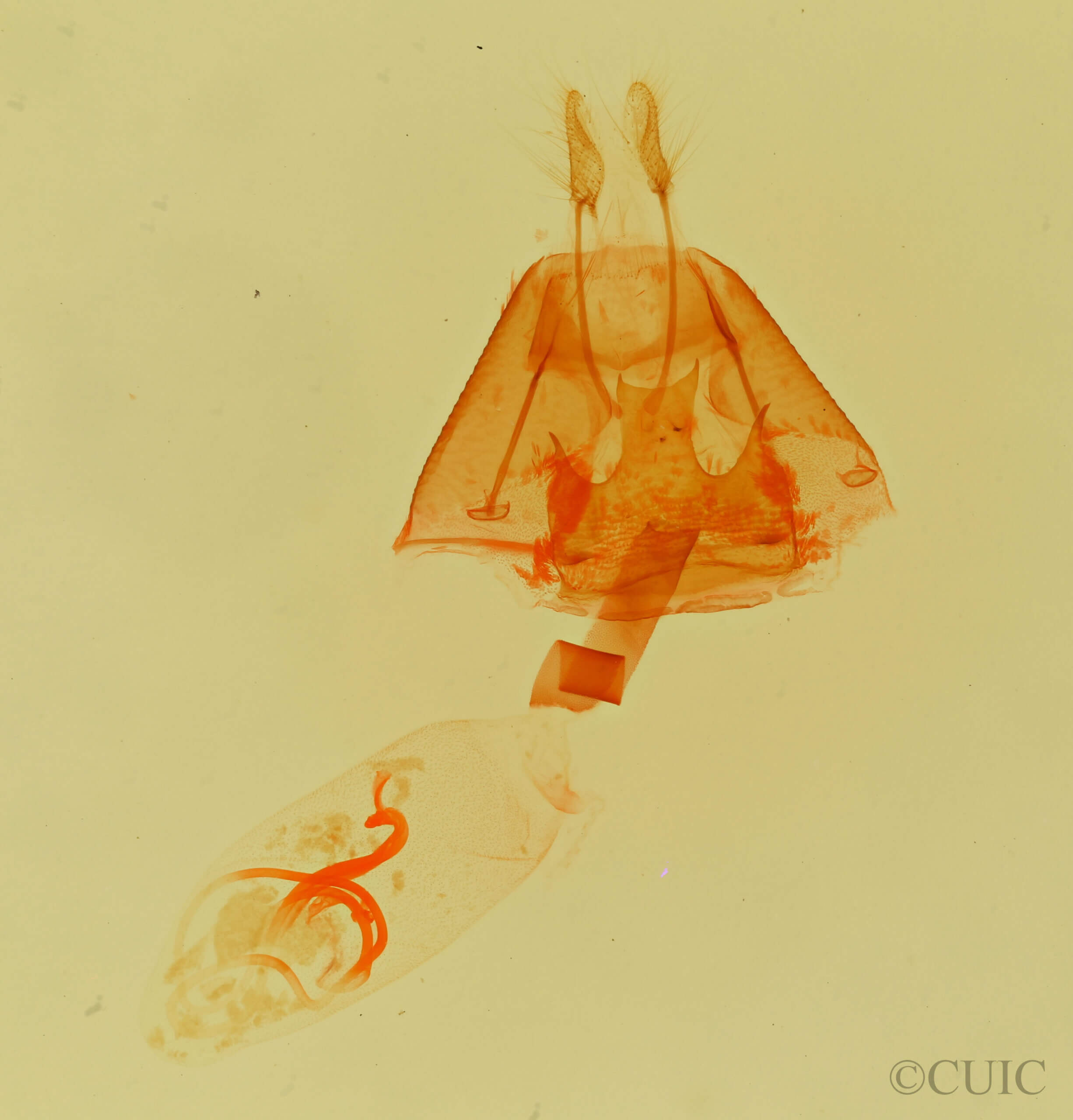 genitalia view of adult Selenisa sueroides