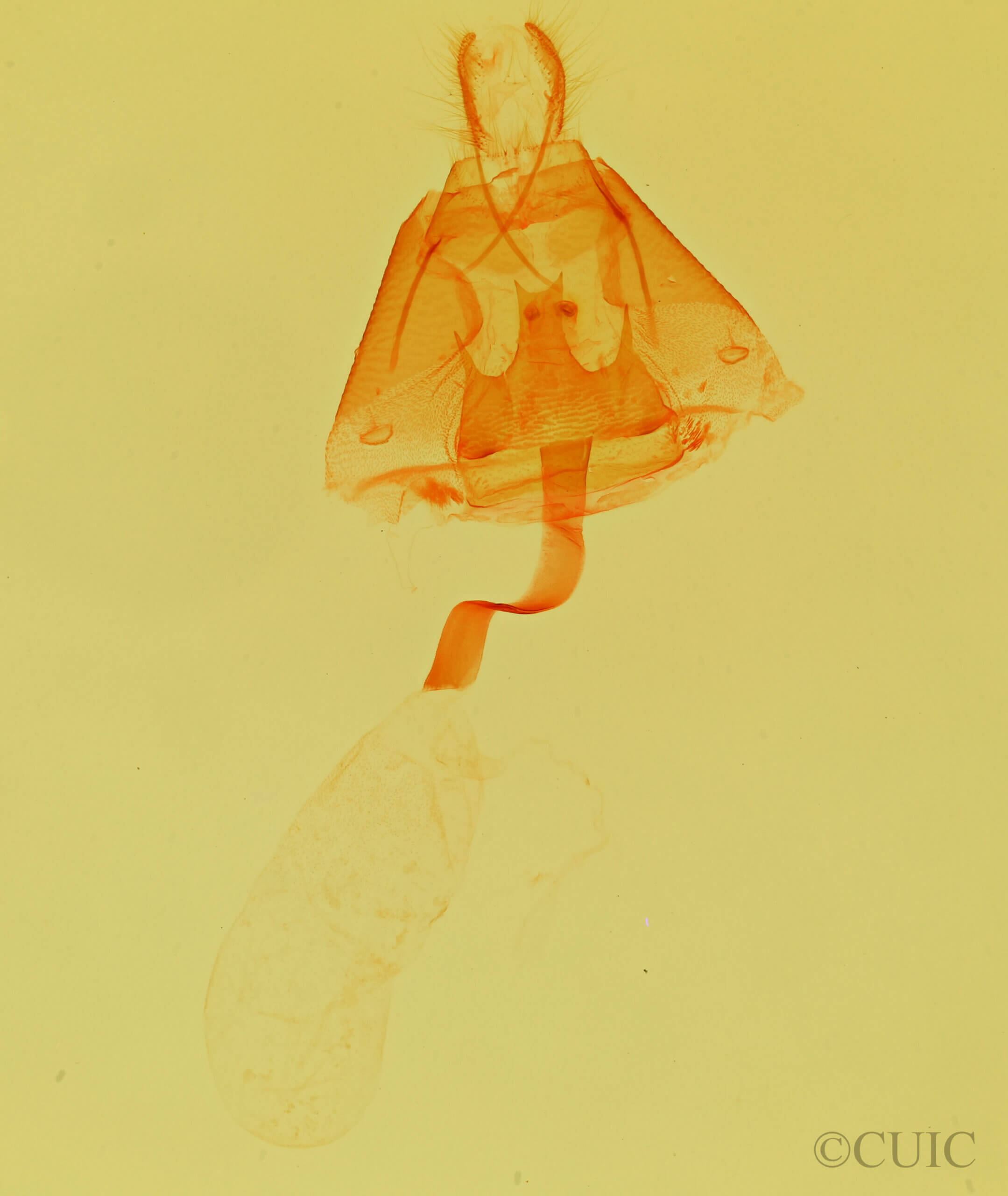 genitalia view of adult Selenisa sueroides