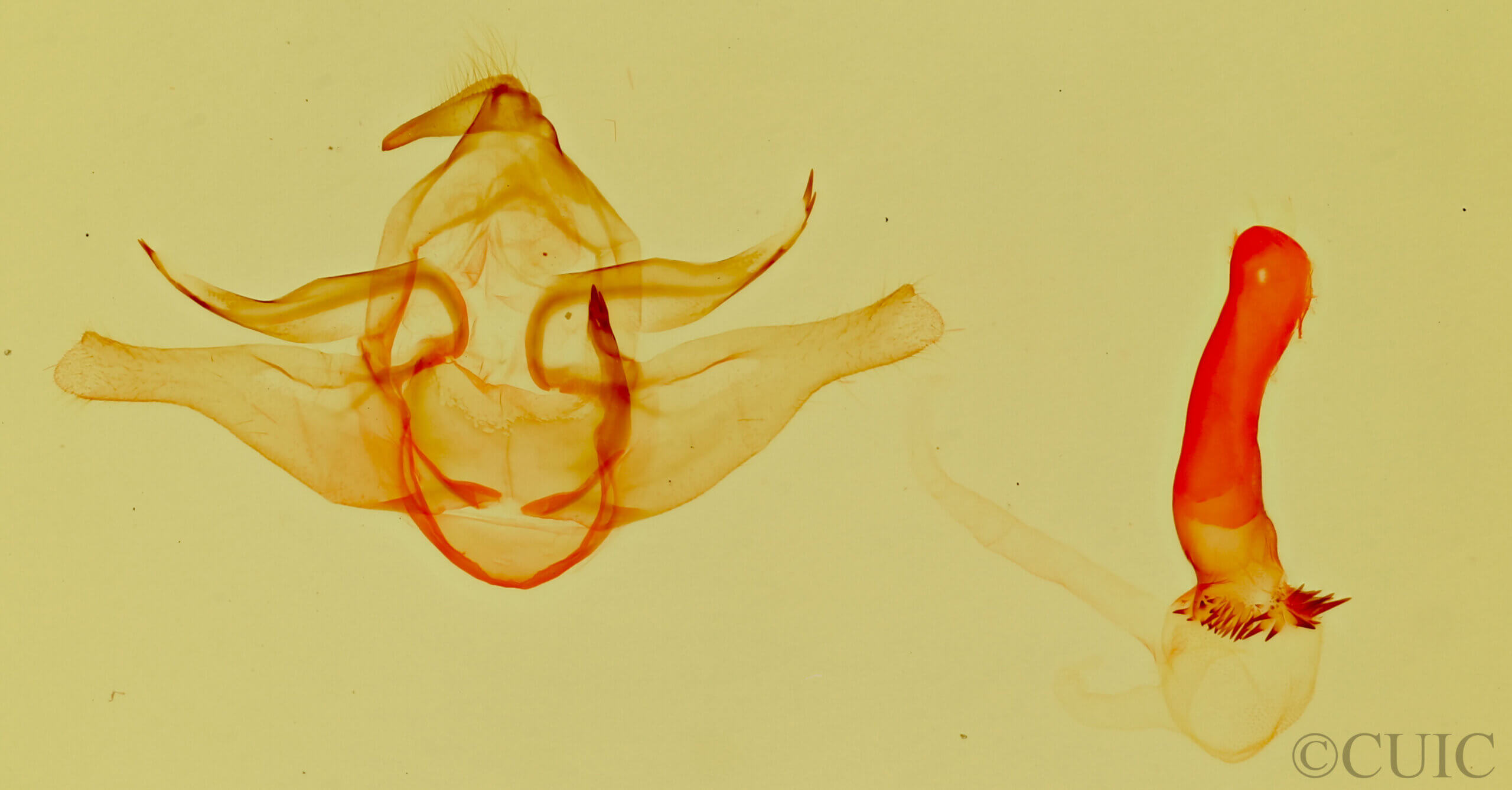 genitalia view of adult Lophocampa annulosa
