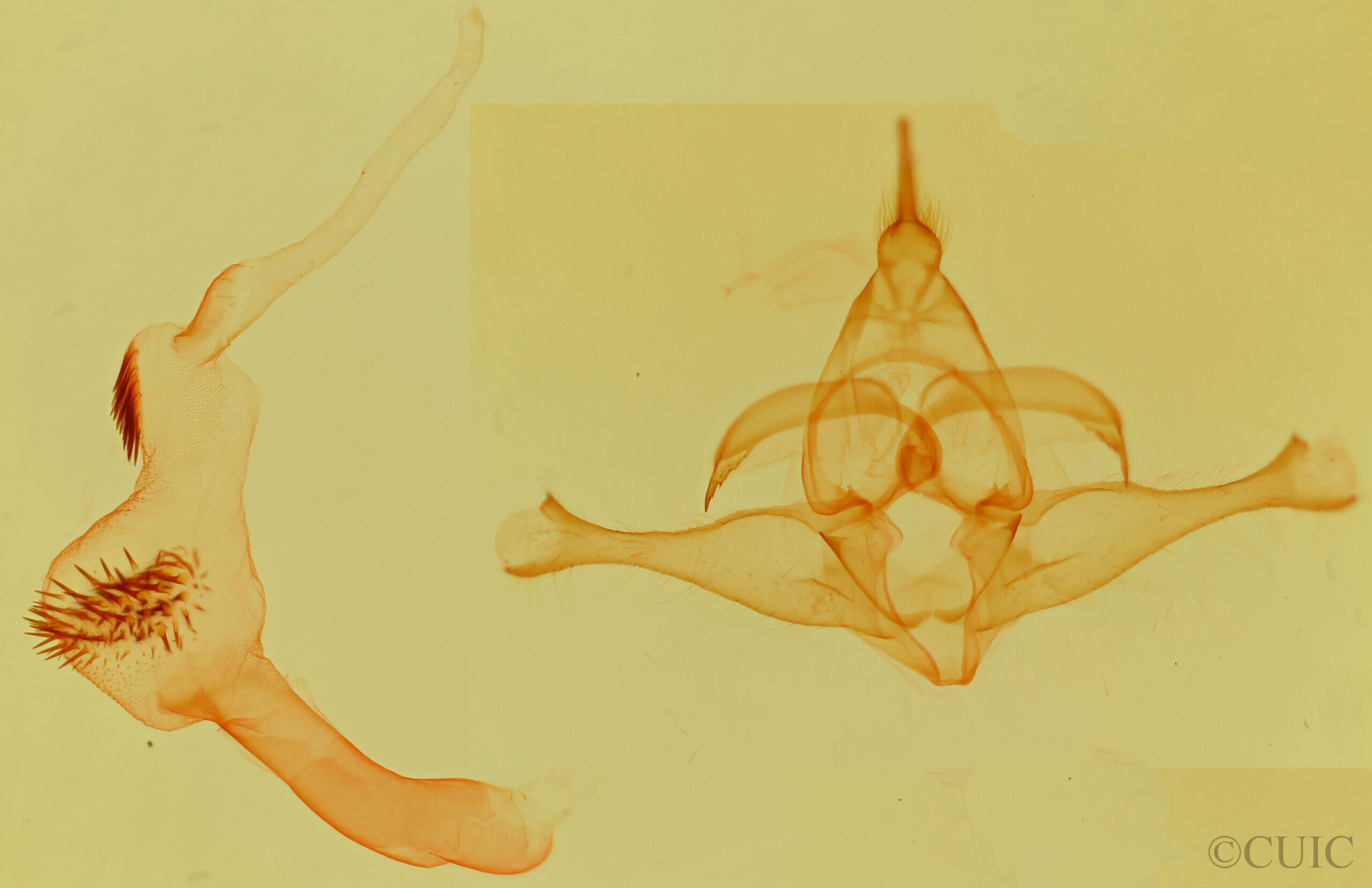 genitalia view of adult Lophocampa citrina