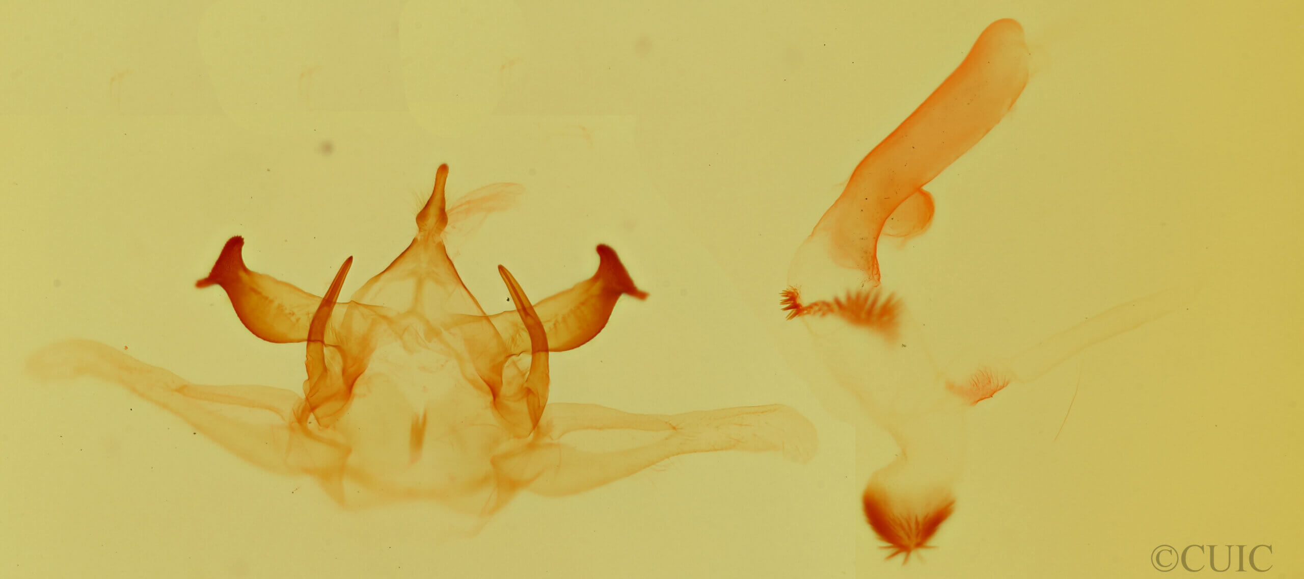 genitalia view of adult Lophocampa annulosa