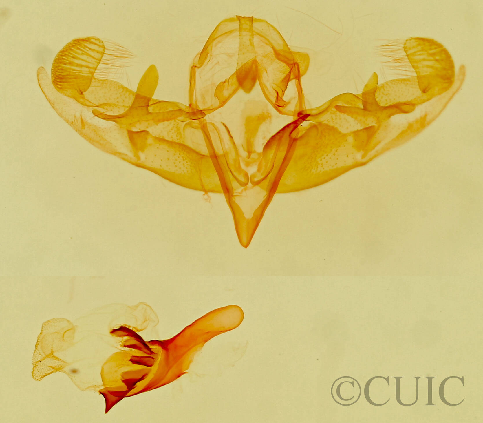 genitalia view of adult Galgula sp.