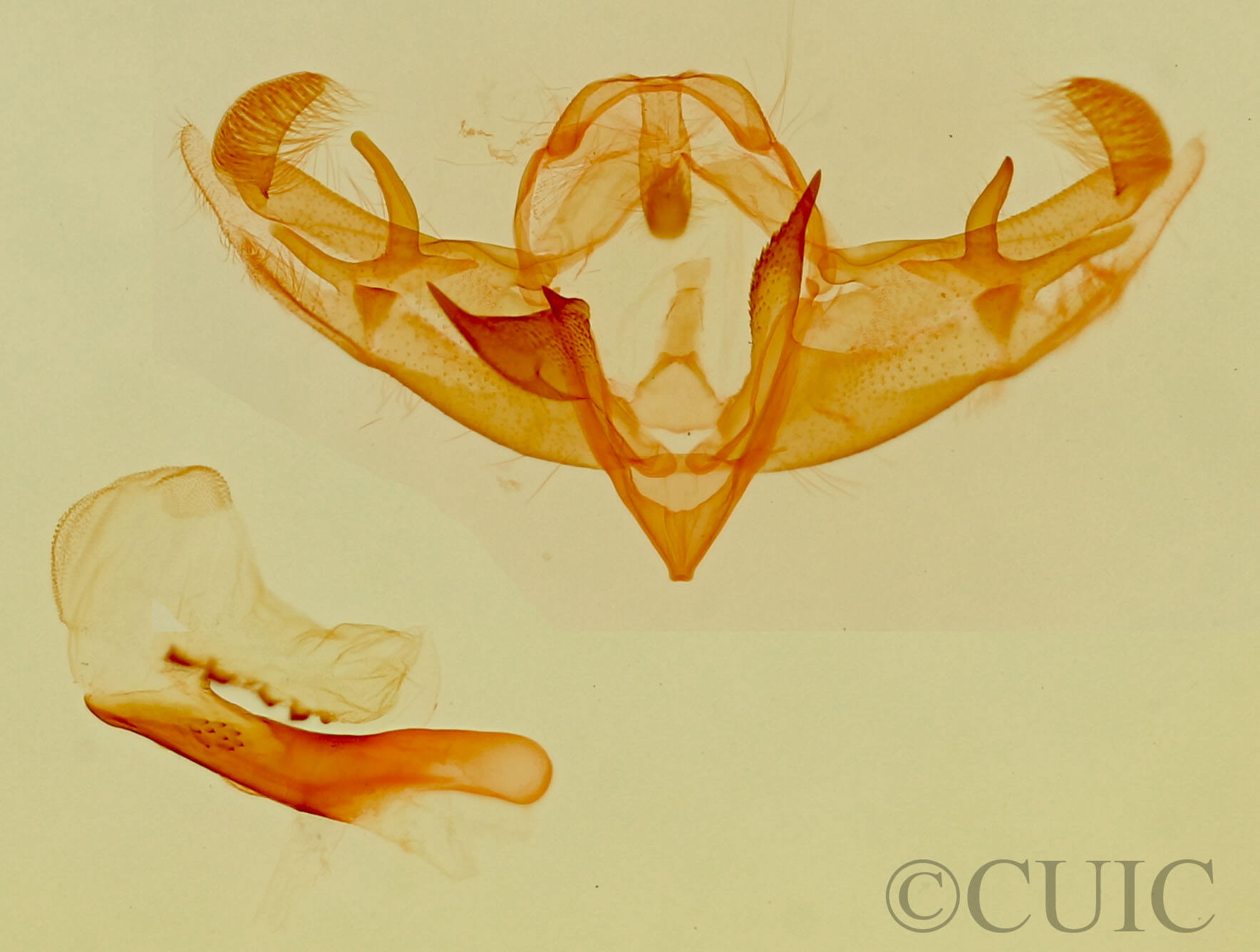 genitalia view of adult Galgula partita