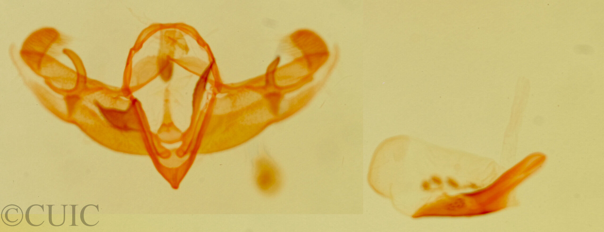 genitalia view of adult Galgula partita