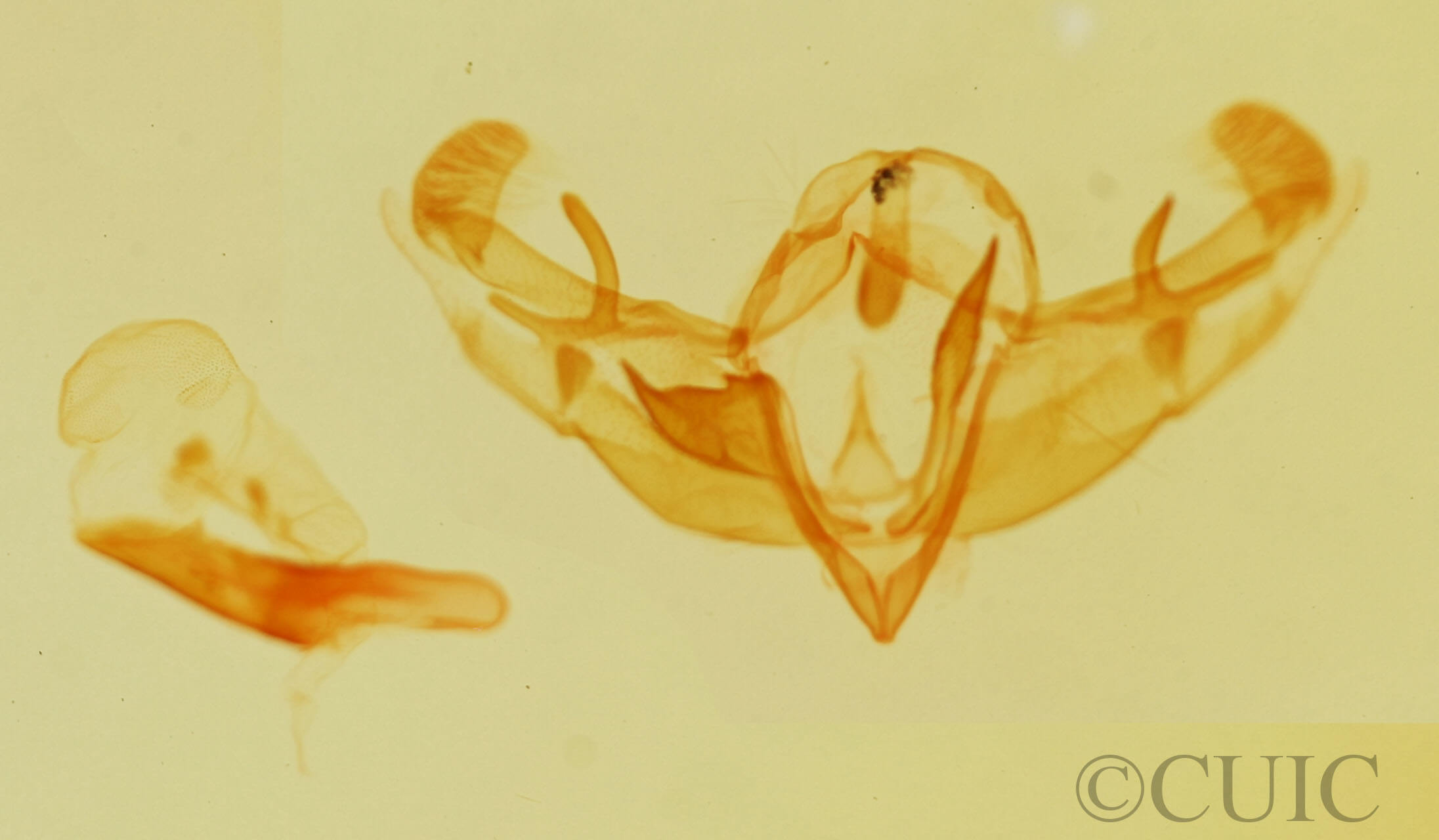 genitalia view of adult Galgula partita