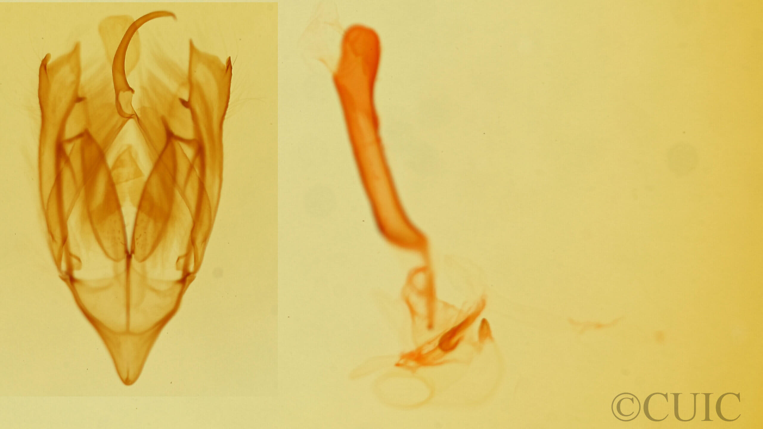 genitalia view of adult Bagisara tristicta