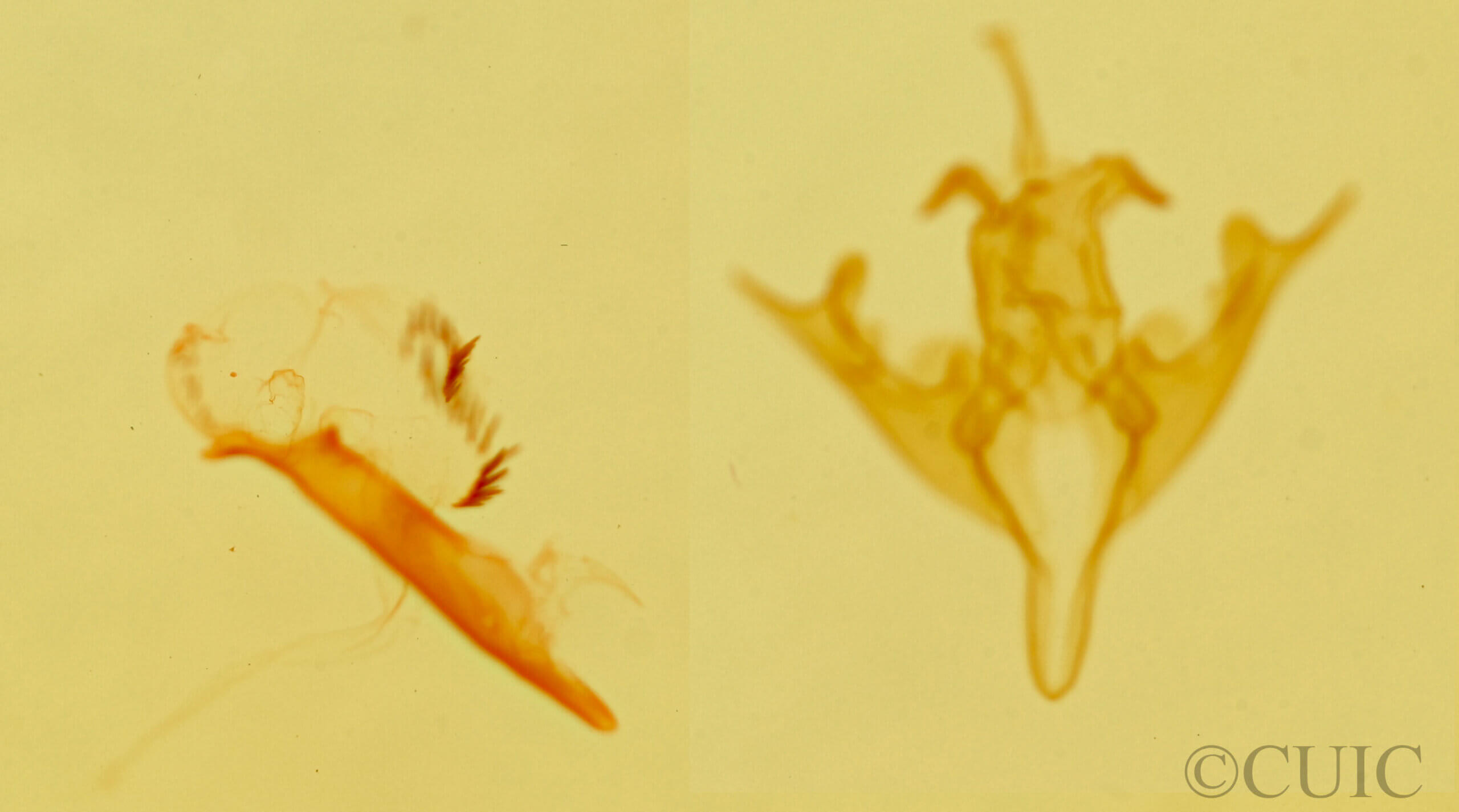 genitalia view of adult Anycteola fotelloides