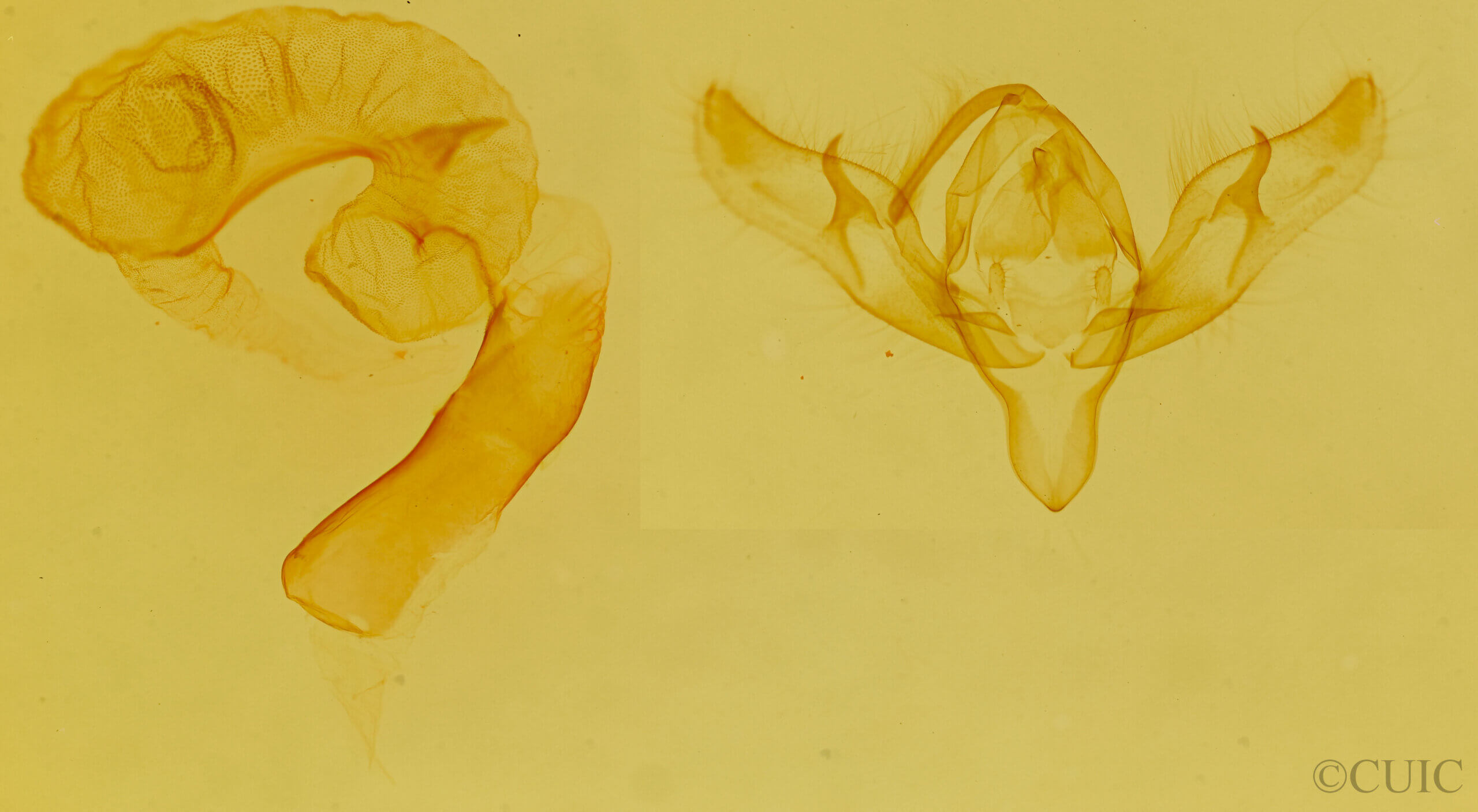 genitalia view of adult Richia parentalis