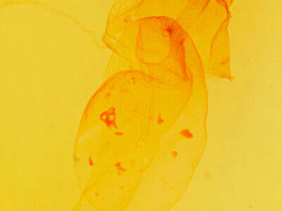 genitalia view of adult Richia parentalis