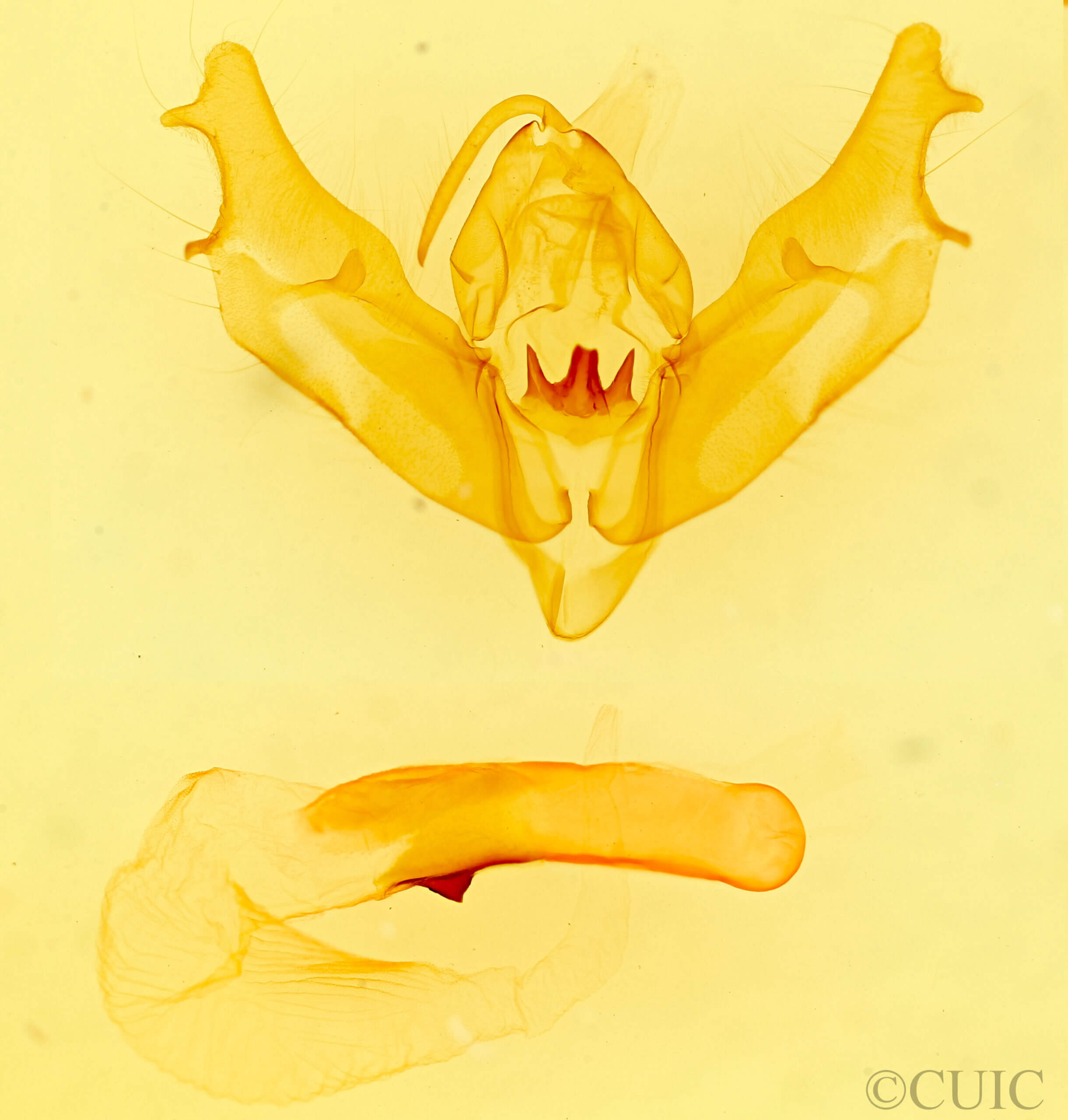 genitalia view of adult Xestia rosifunda