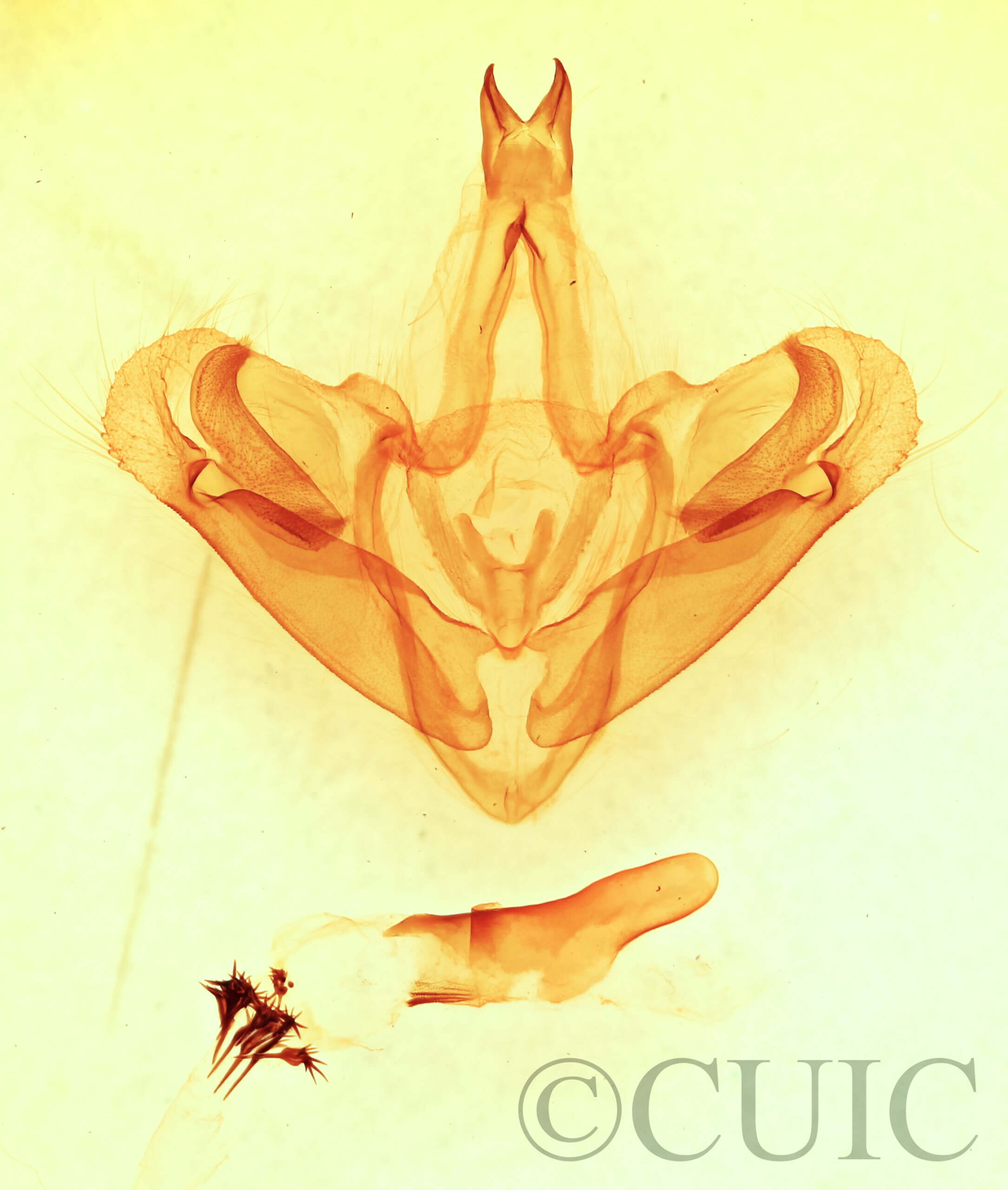 genitalia view of adult Goacampa variabilis