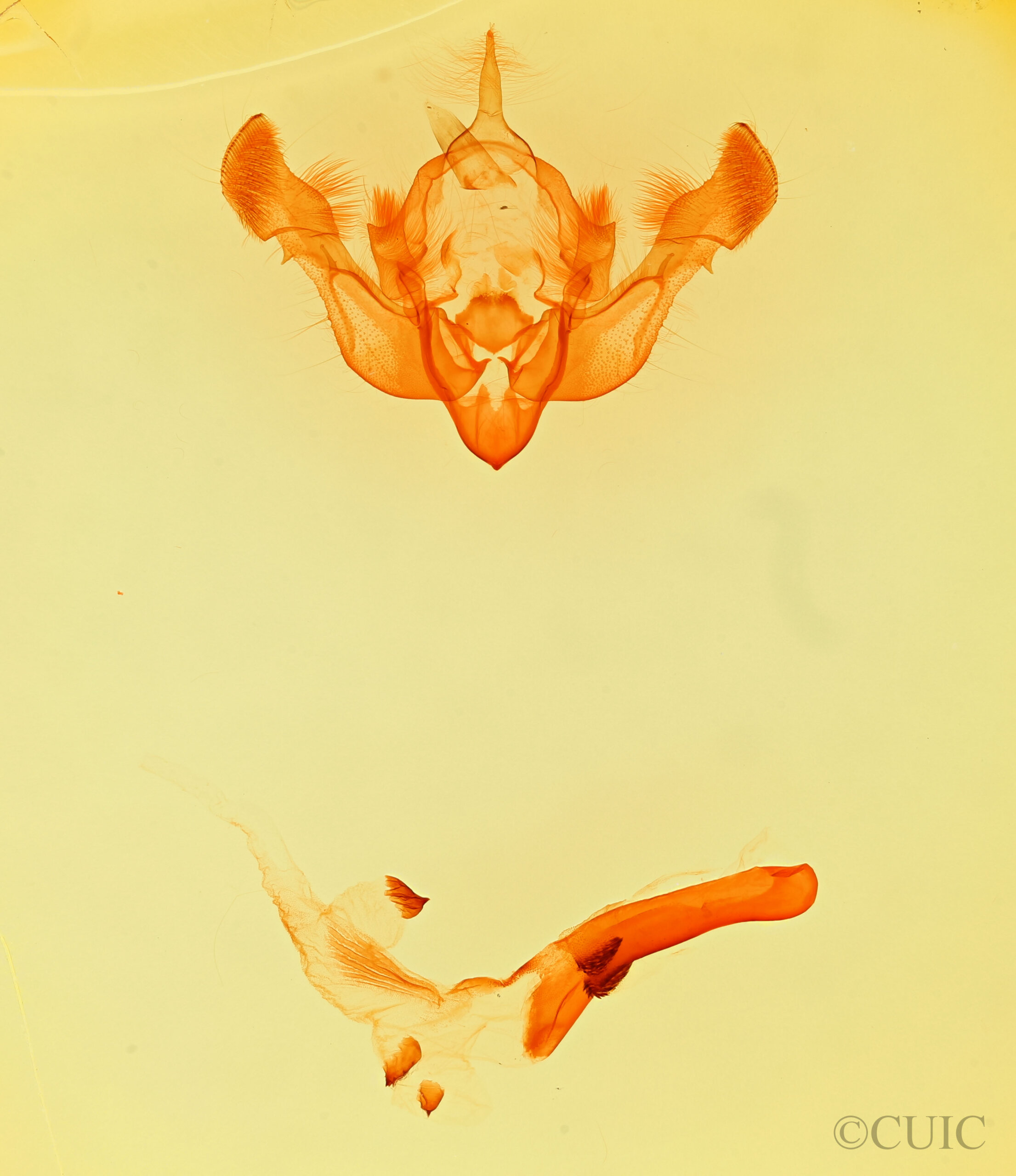 genitalia view of adult Oligia egens