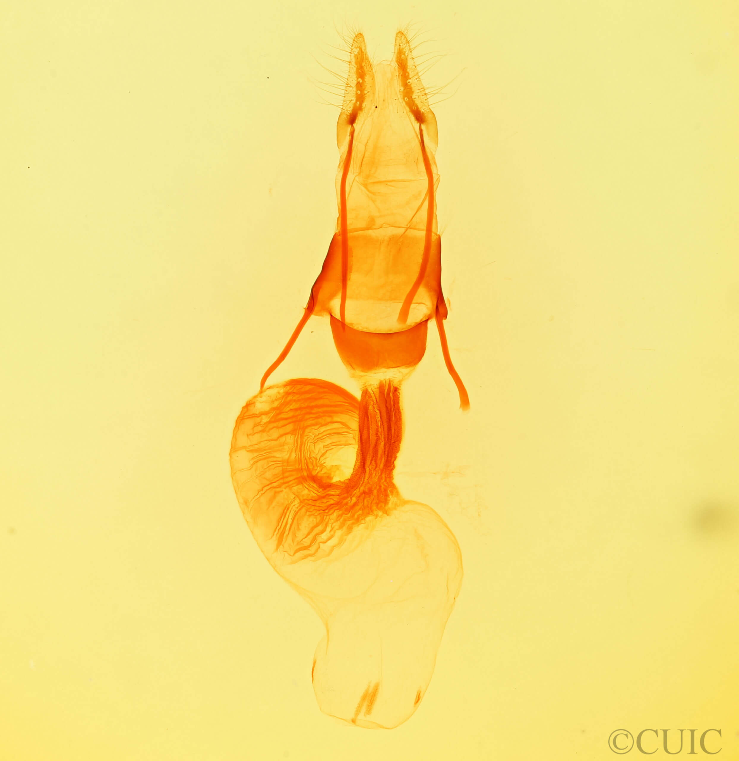 genitalia view of adult Oligia egens