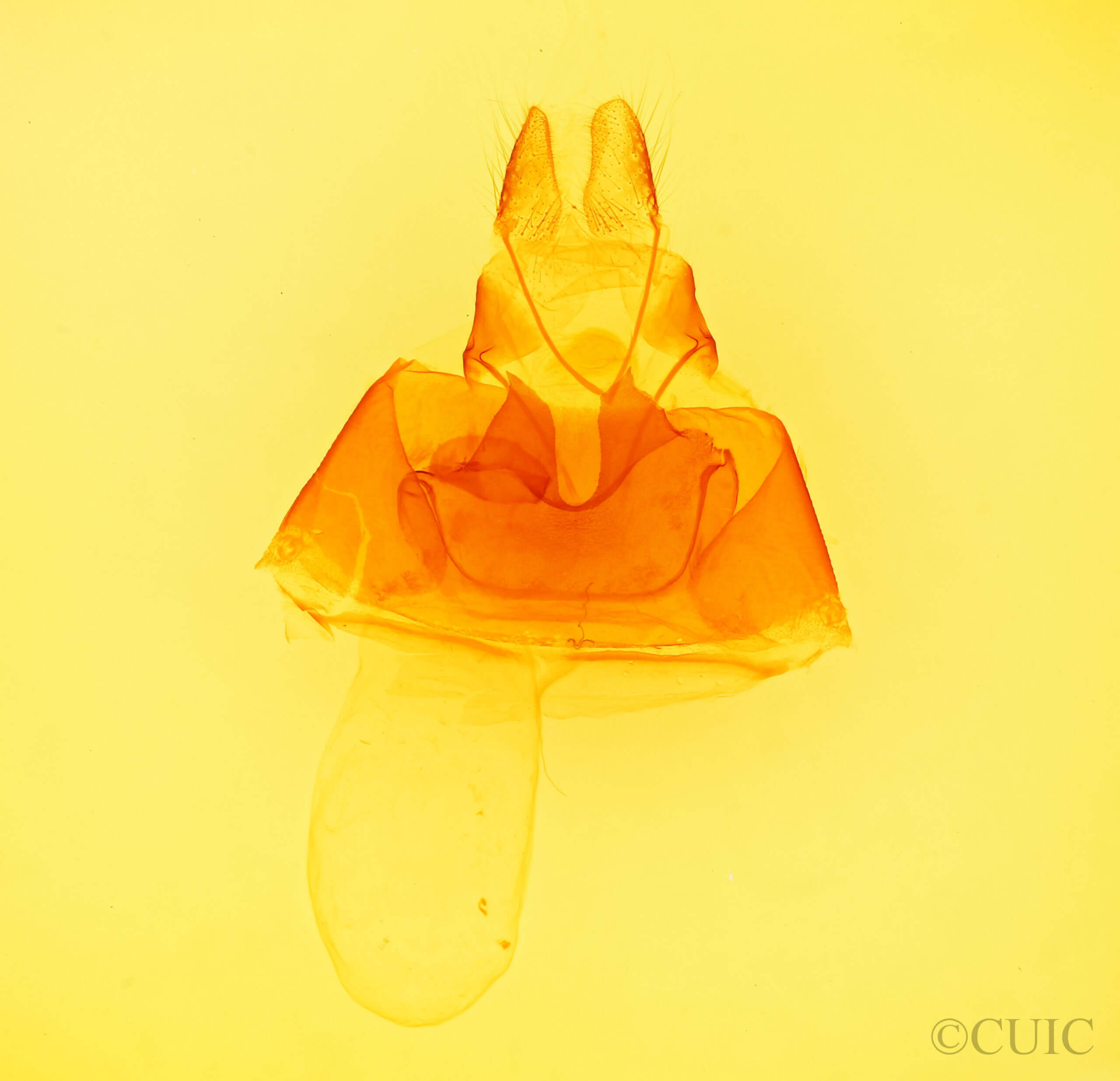 genitalia view of adult Metria amella