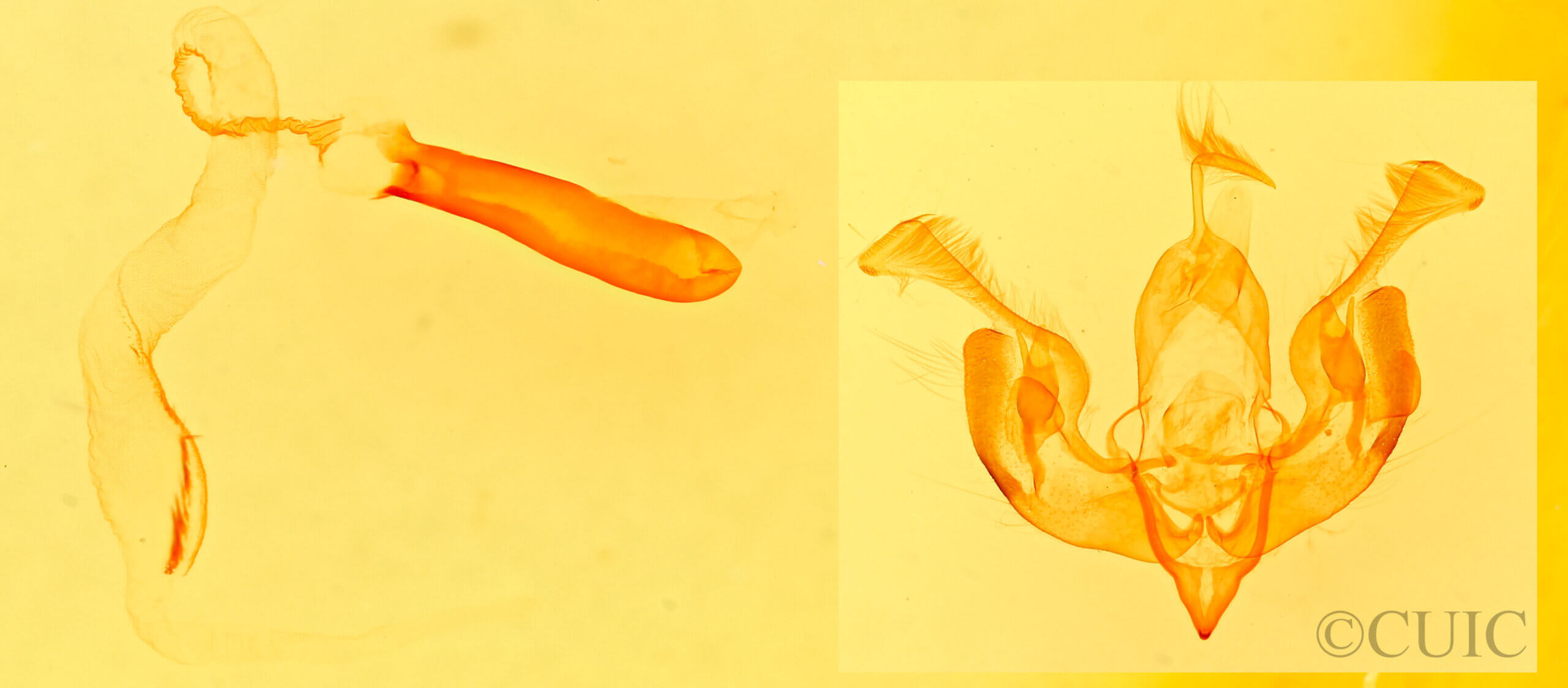 genitalia view of adult Lacinipolia strigicollis