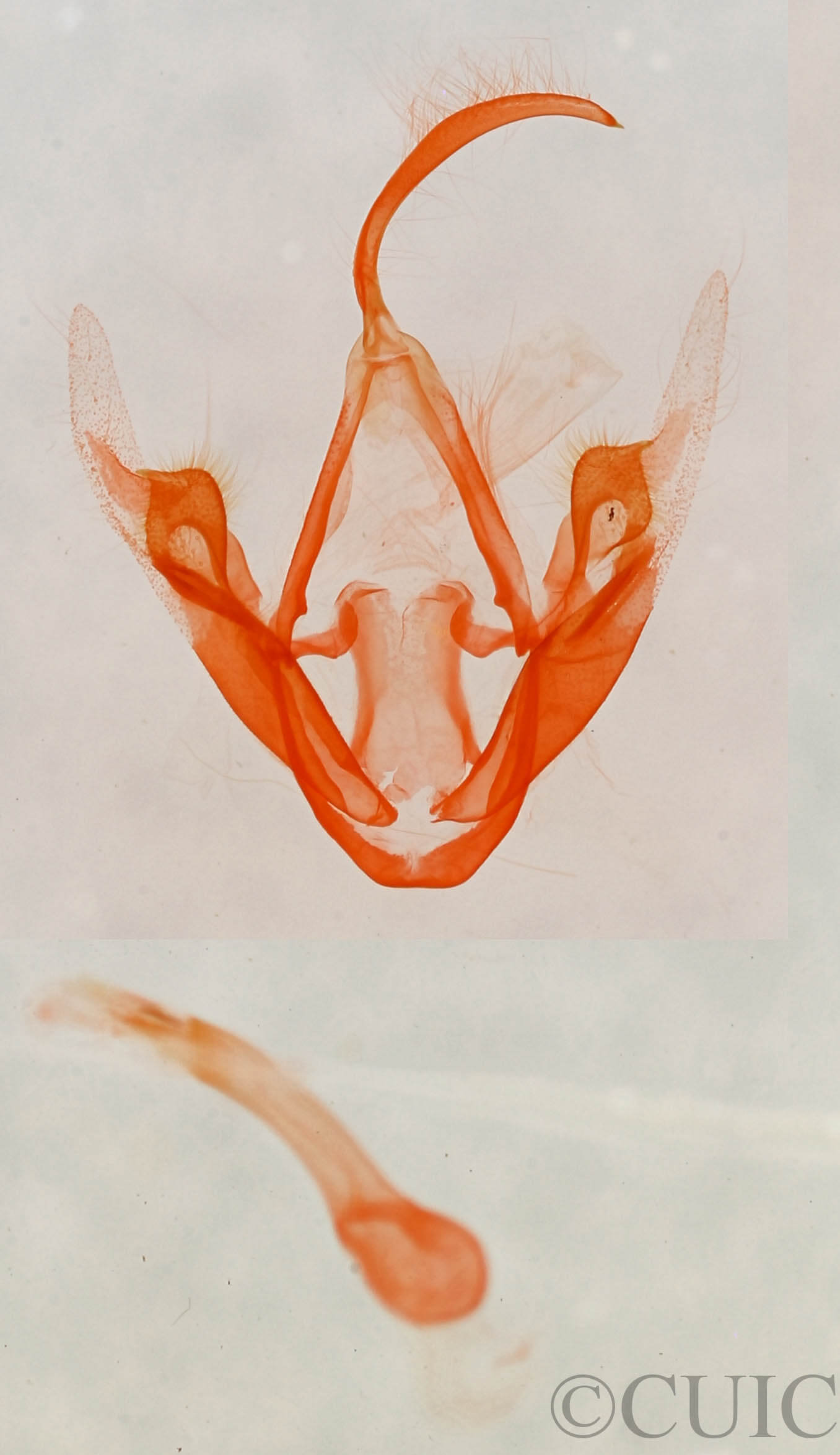 genitalia view of adult Metalectra quadrisignata