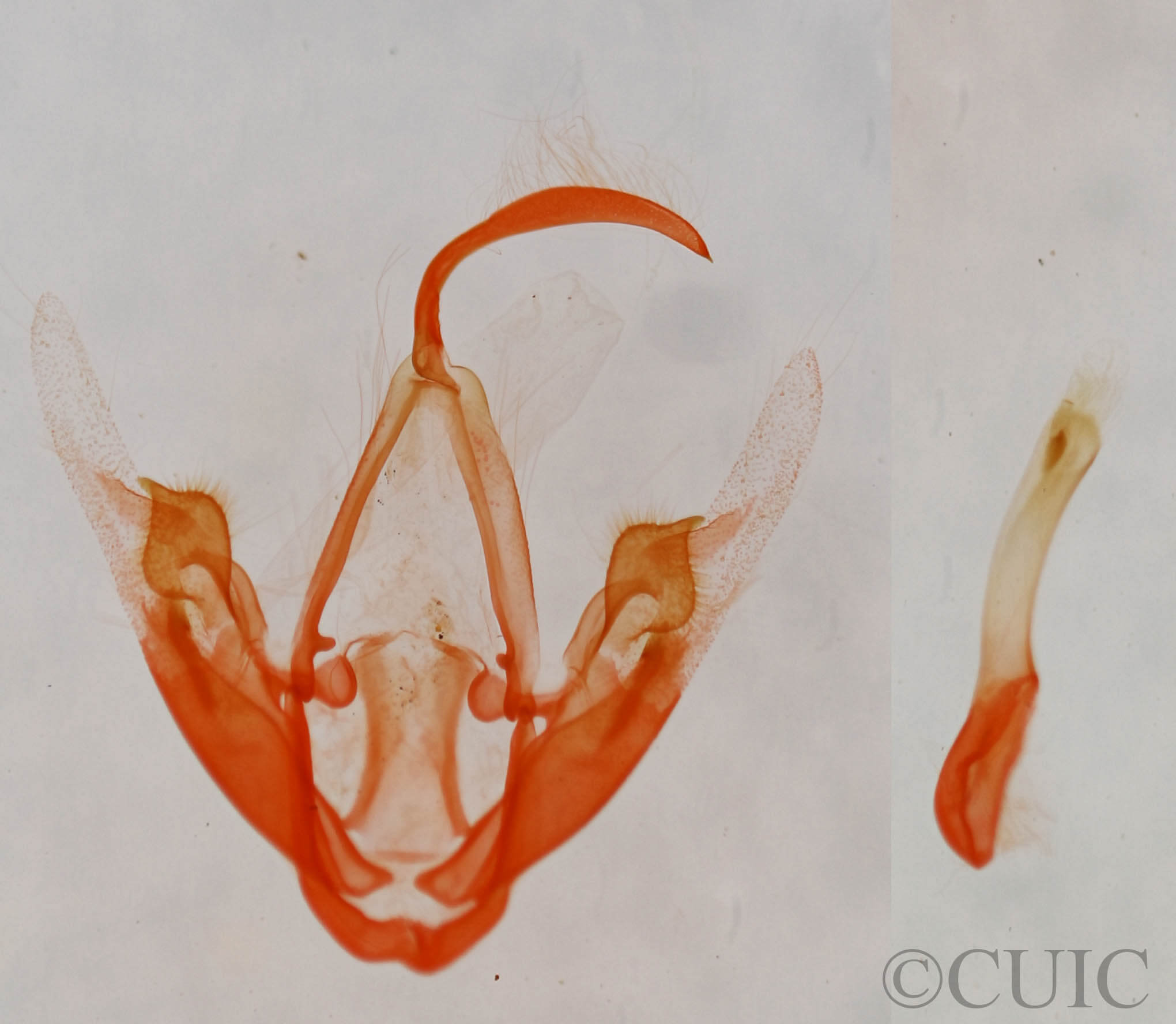 genitalia view of adult Metalectra quadrisignata