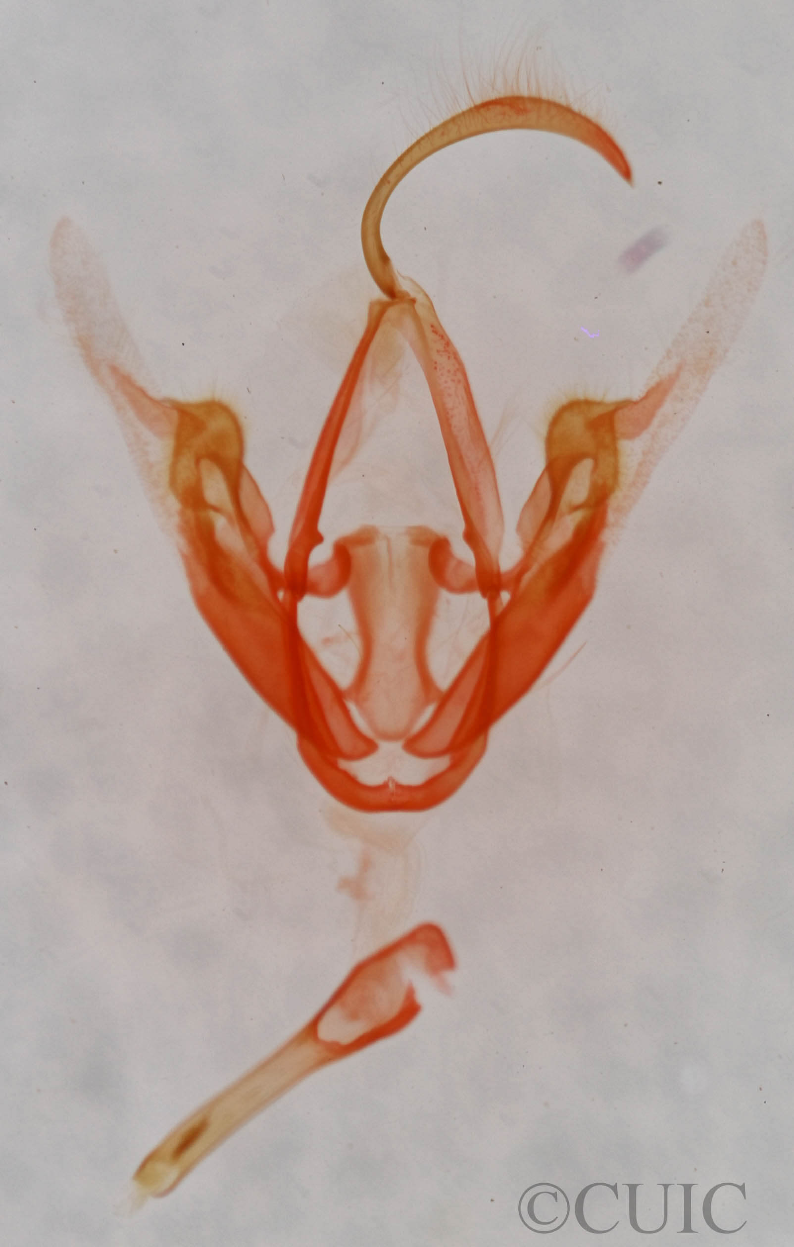 genitalia view of adult Metalectra quadrisignata