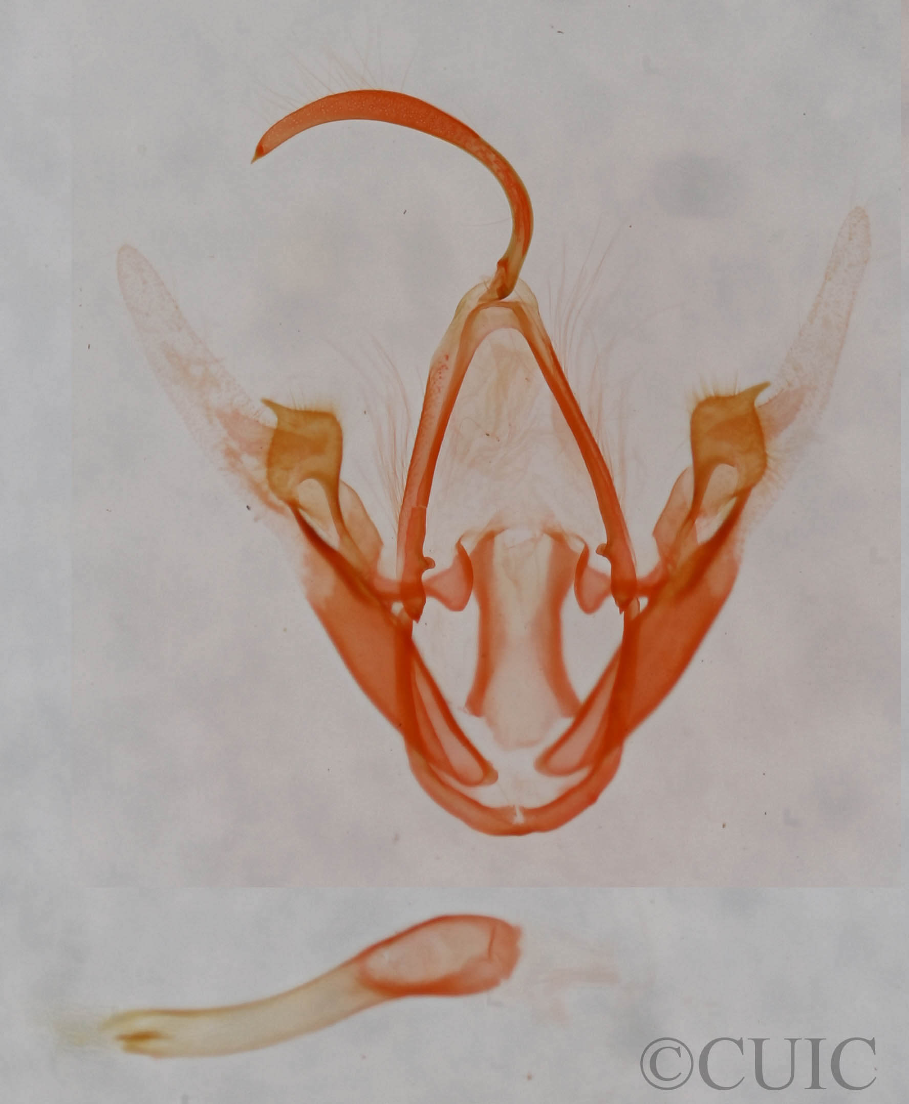 genitalia view of adult Metalectra quadrisignata