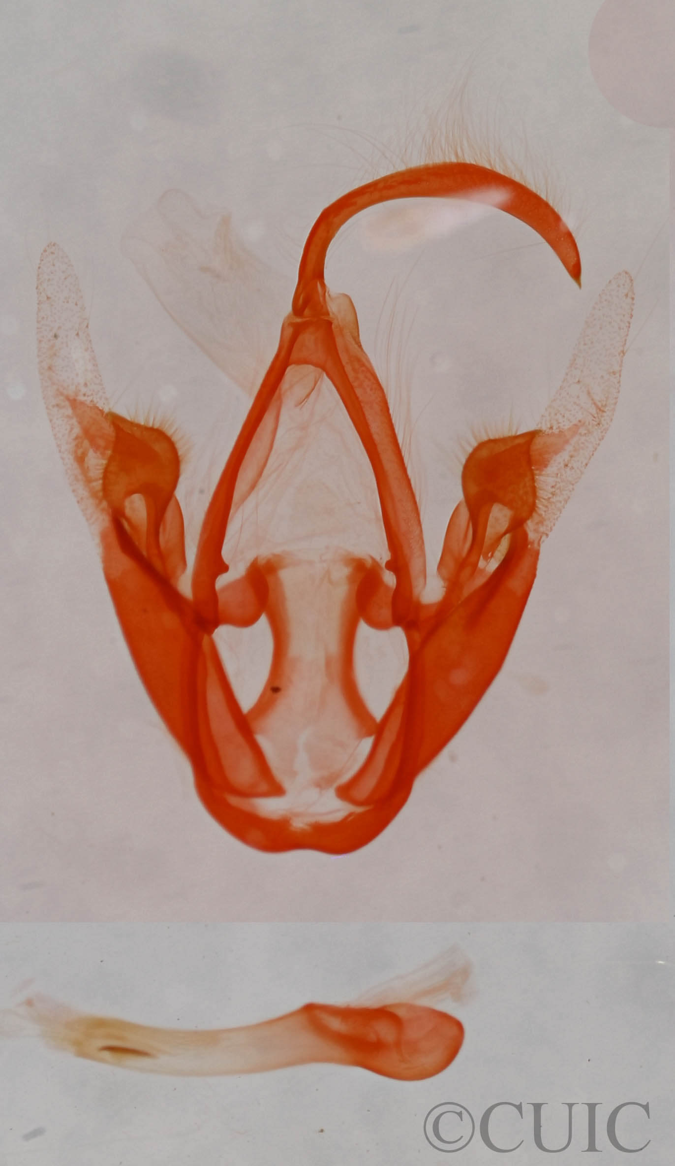 genitalia view of adult Metalectra quadrisignata