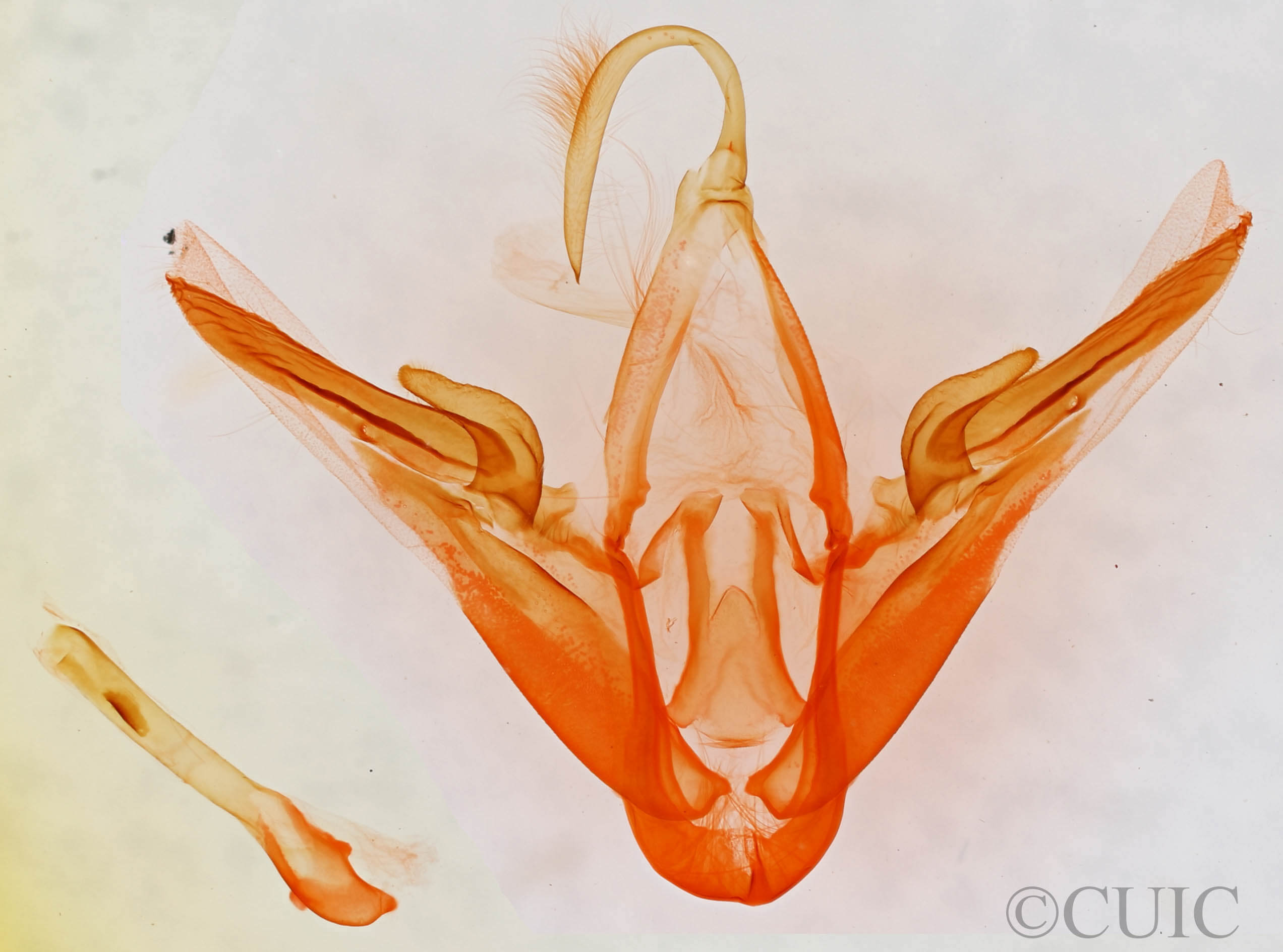 genitalia view of adult Metalectra bigallis