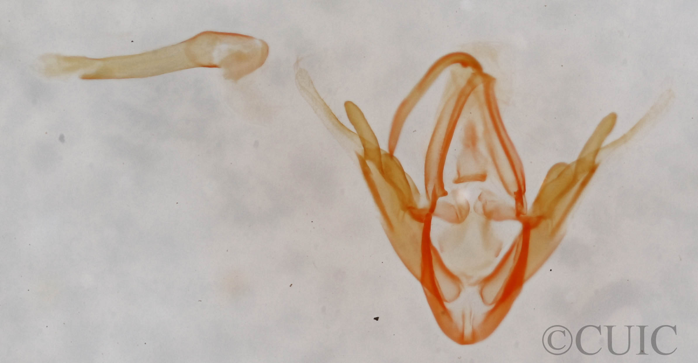 genitalia view of adult Metalectra edilis