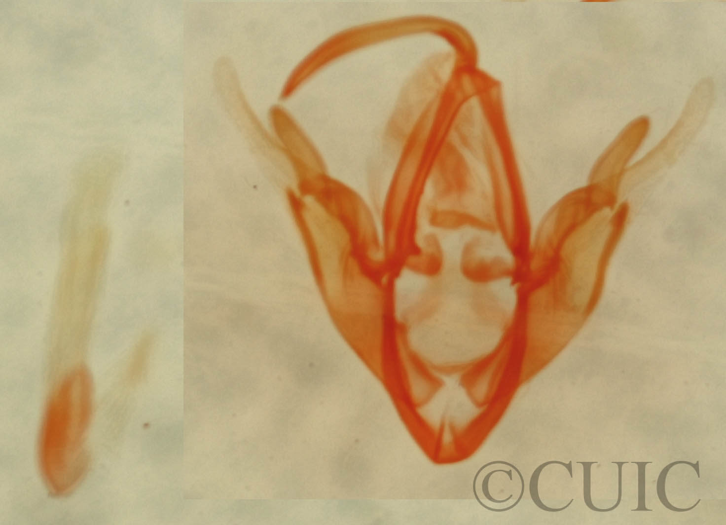 genitalia view of adult Metalectra cincta?