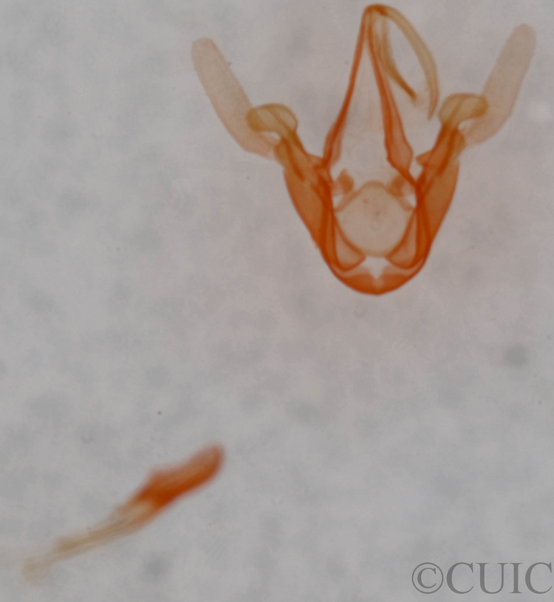 genitalia view of adult Metalectra albilinea