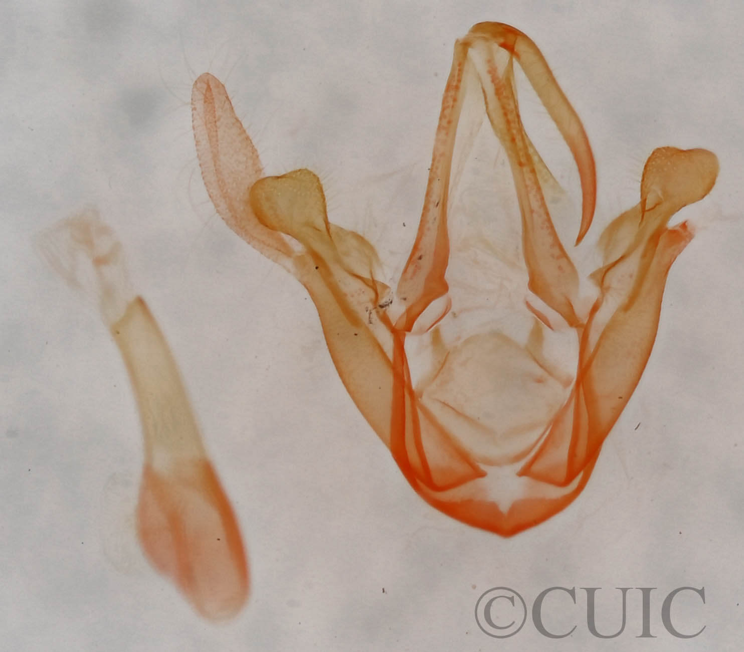 genitalia view of adult Metalectra miserulata