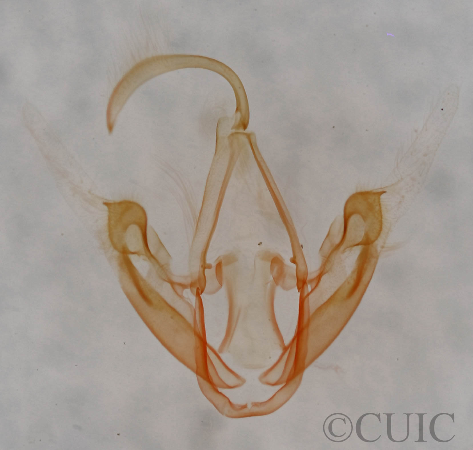 genitalia view of adult Metalectra quadrisignata