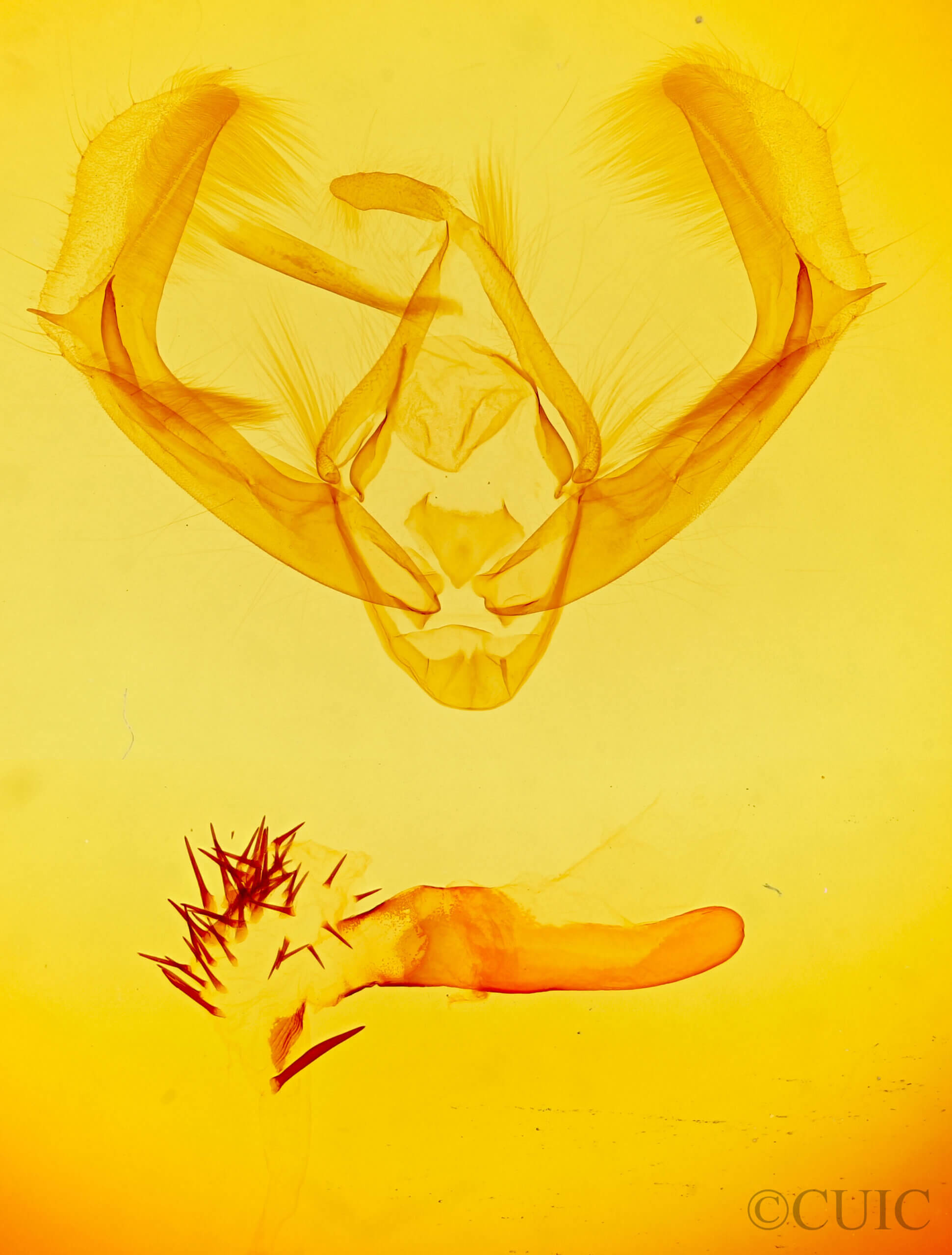 genitalia view of adult Paratrachea sp.