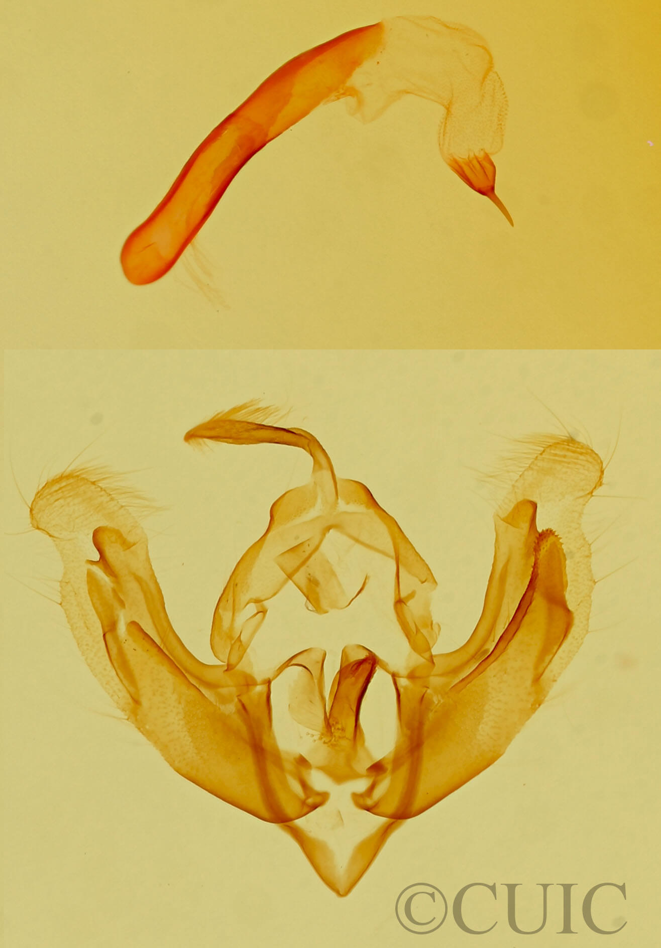 genitalia view of adult Hadenella pergentilis