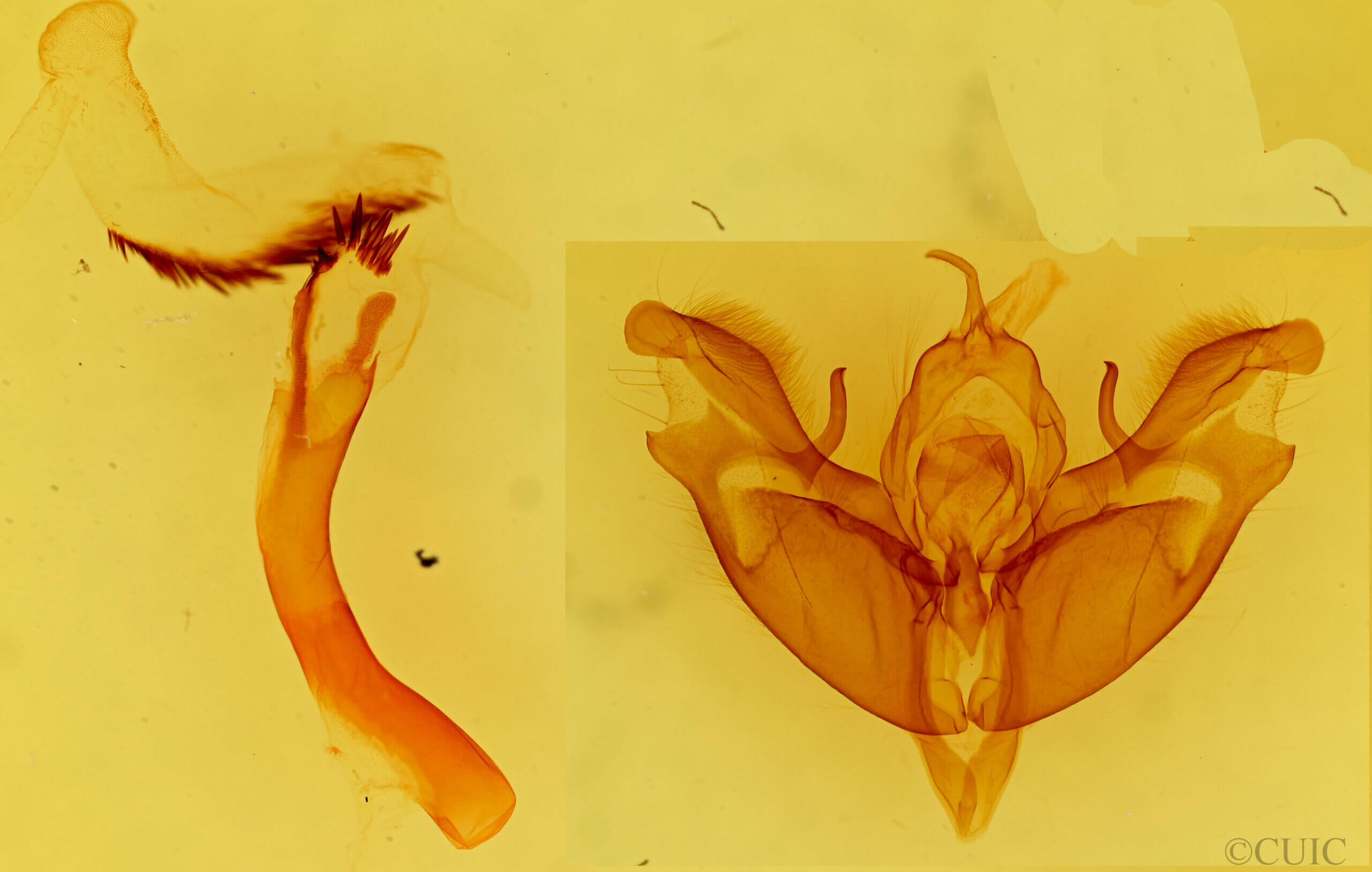 genitalia view of adult Protoperigea posticata