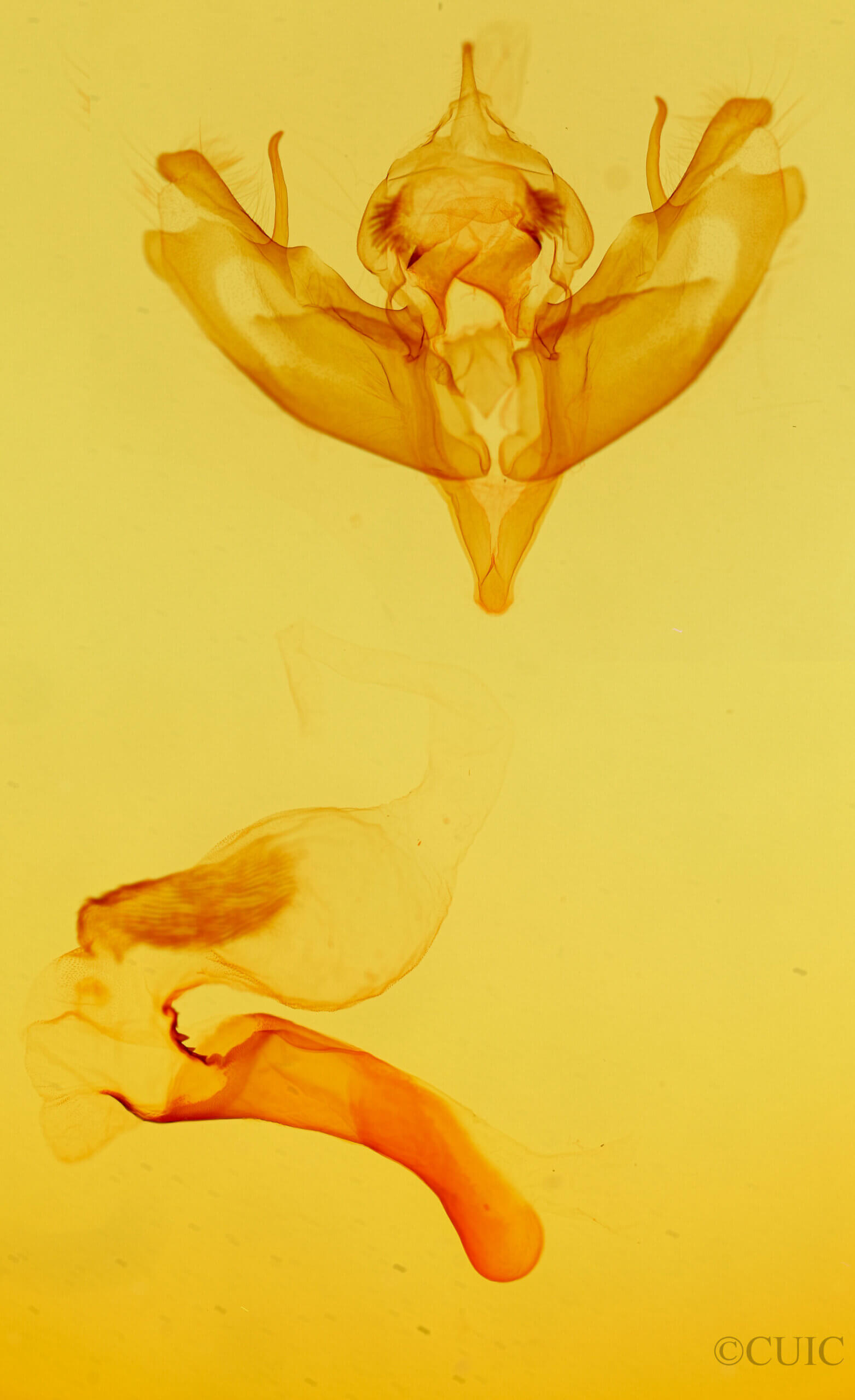 genitalia view of adult Protoperigea posticata