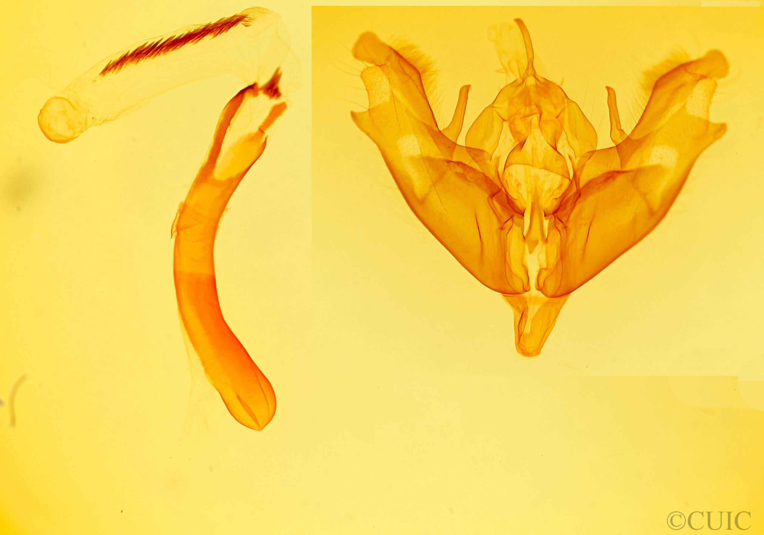 genitalia view of adult Protoperigea posticata