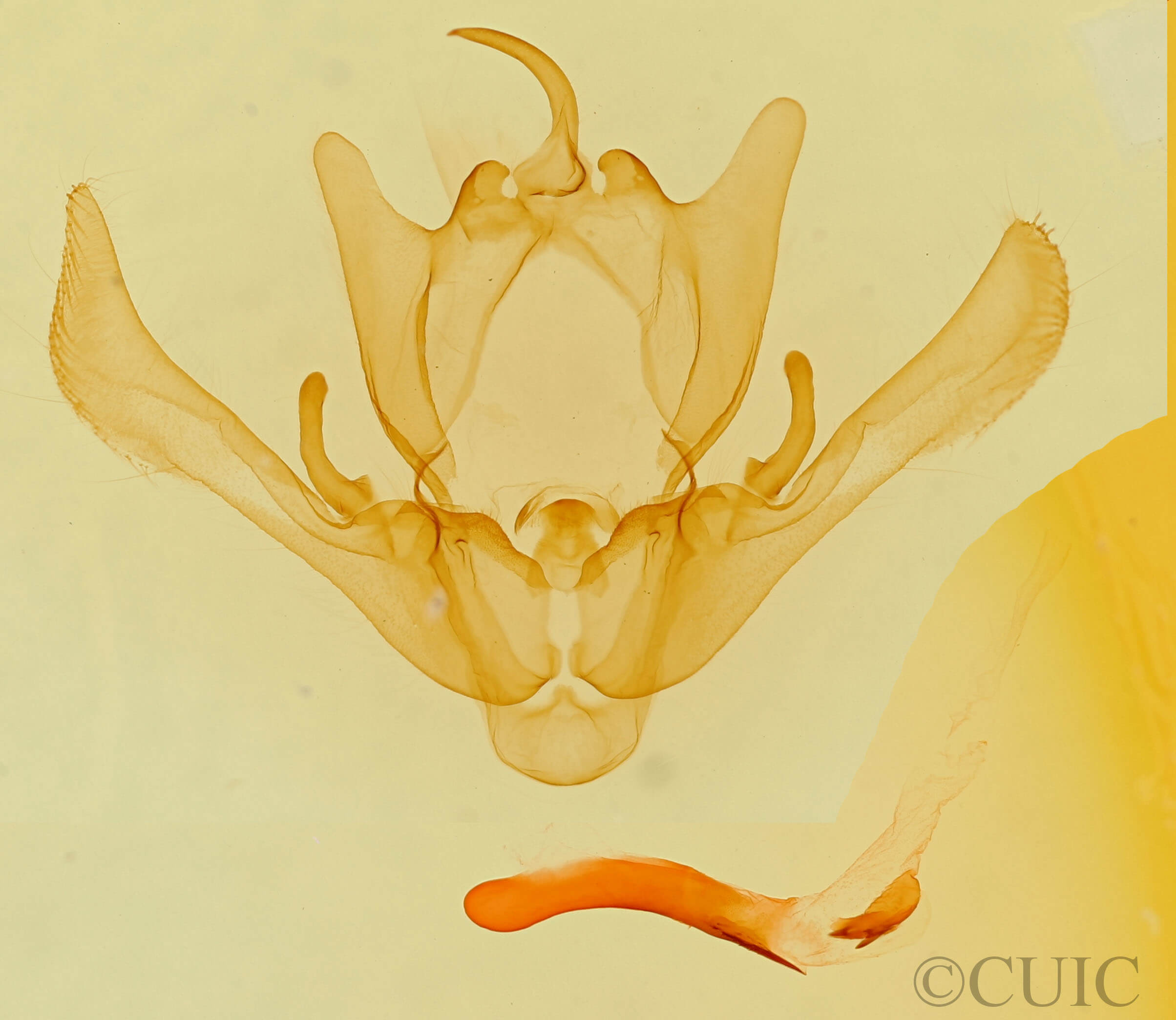 genitalia view of adult Enargia infumata?