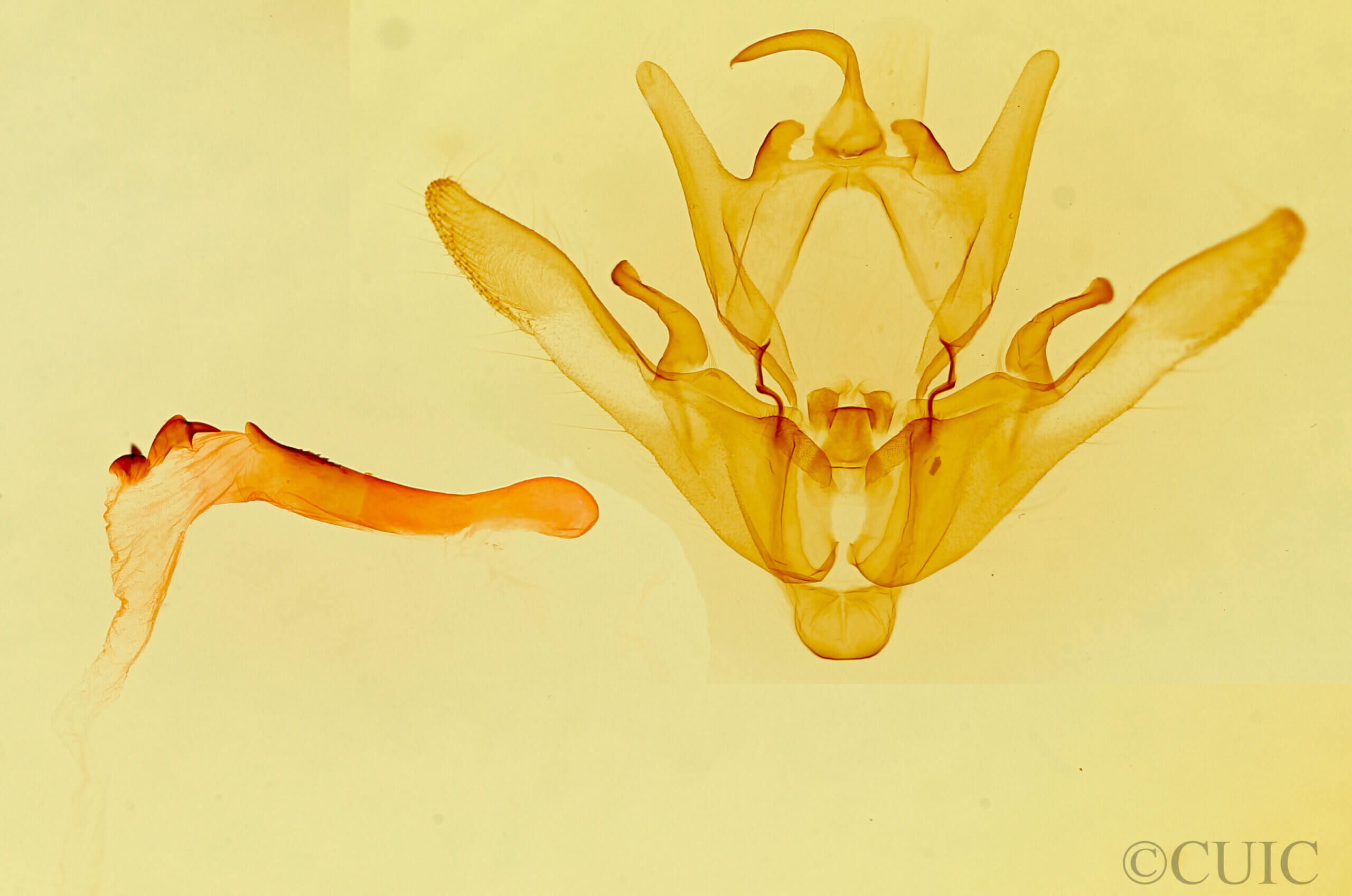 genitalia view of adult Enargia decolor