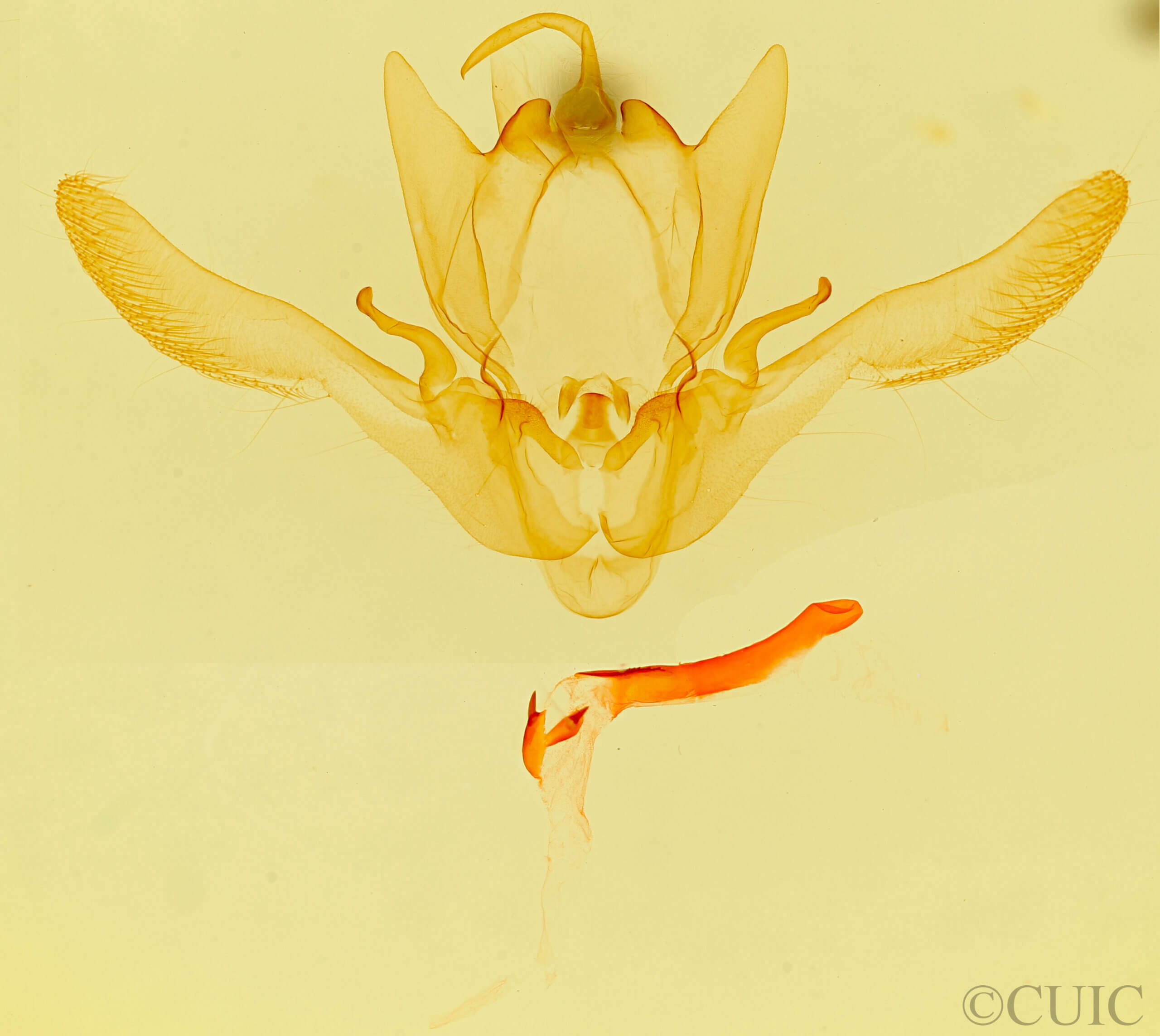 genitalia view of adult Enargia infumata